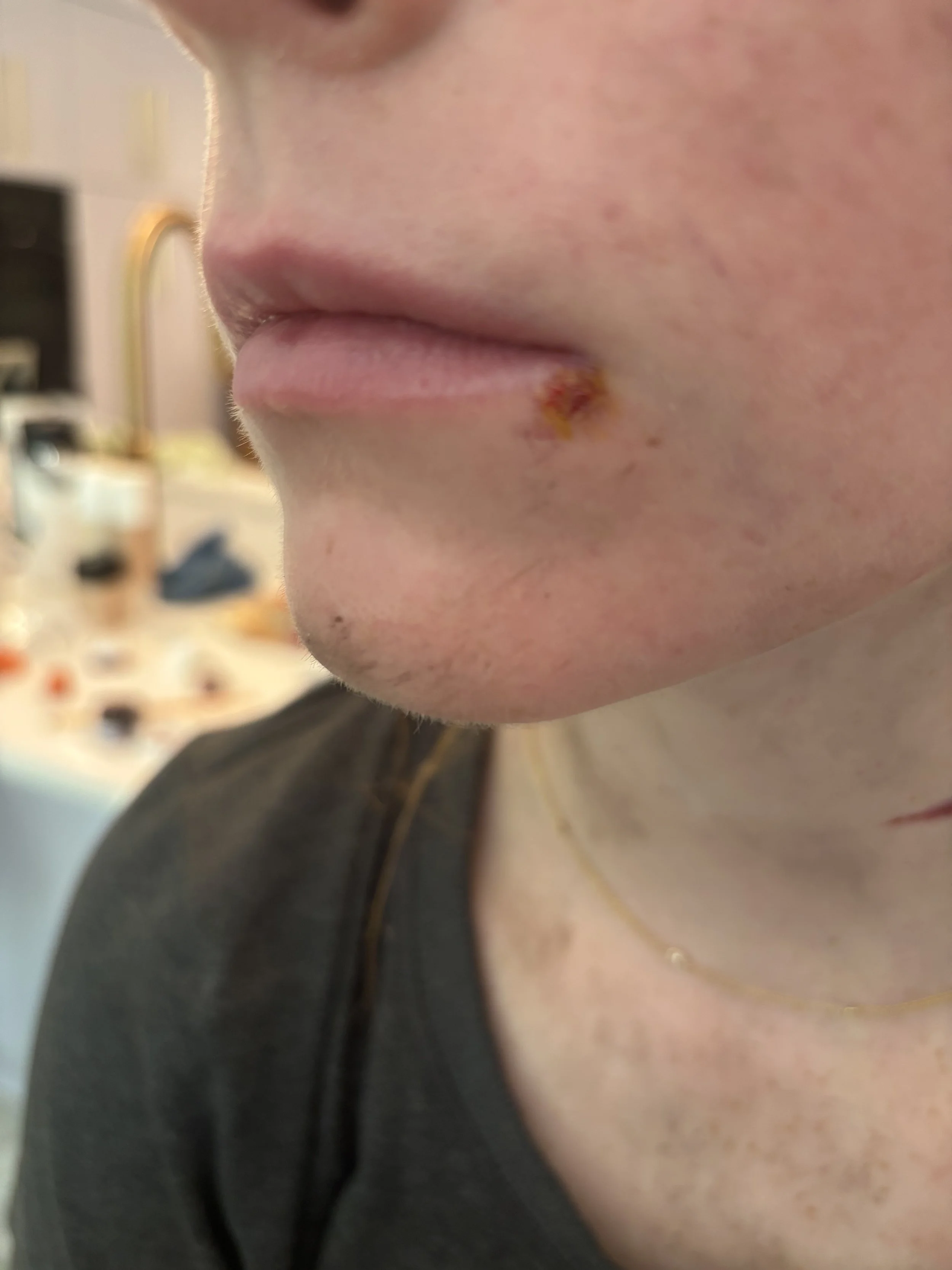 AFTER: Basic FX - Scab