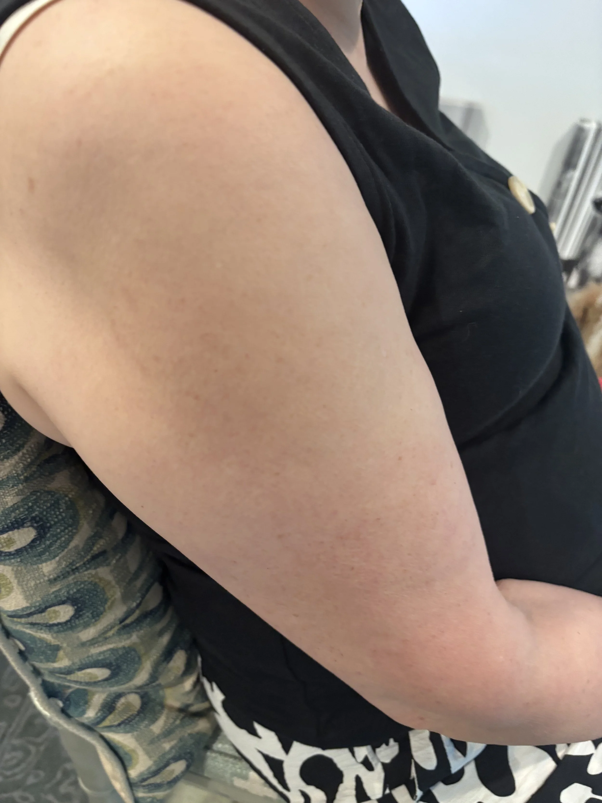 BEFORE: Tattoos - Application