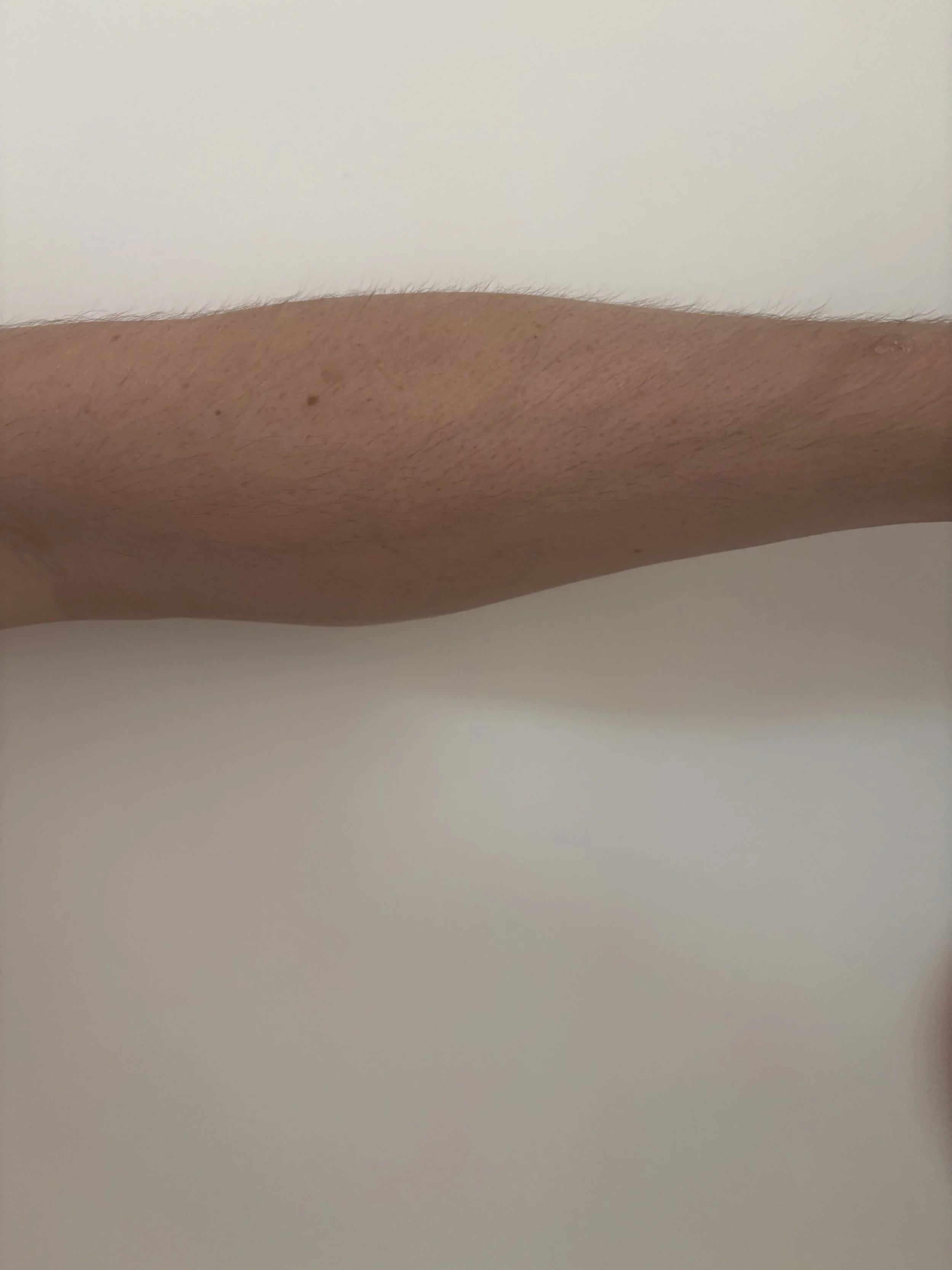 BEFORE: Basic FX - Bruise