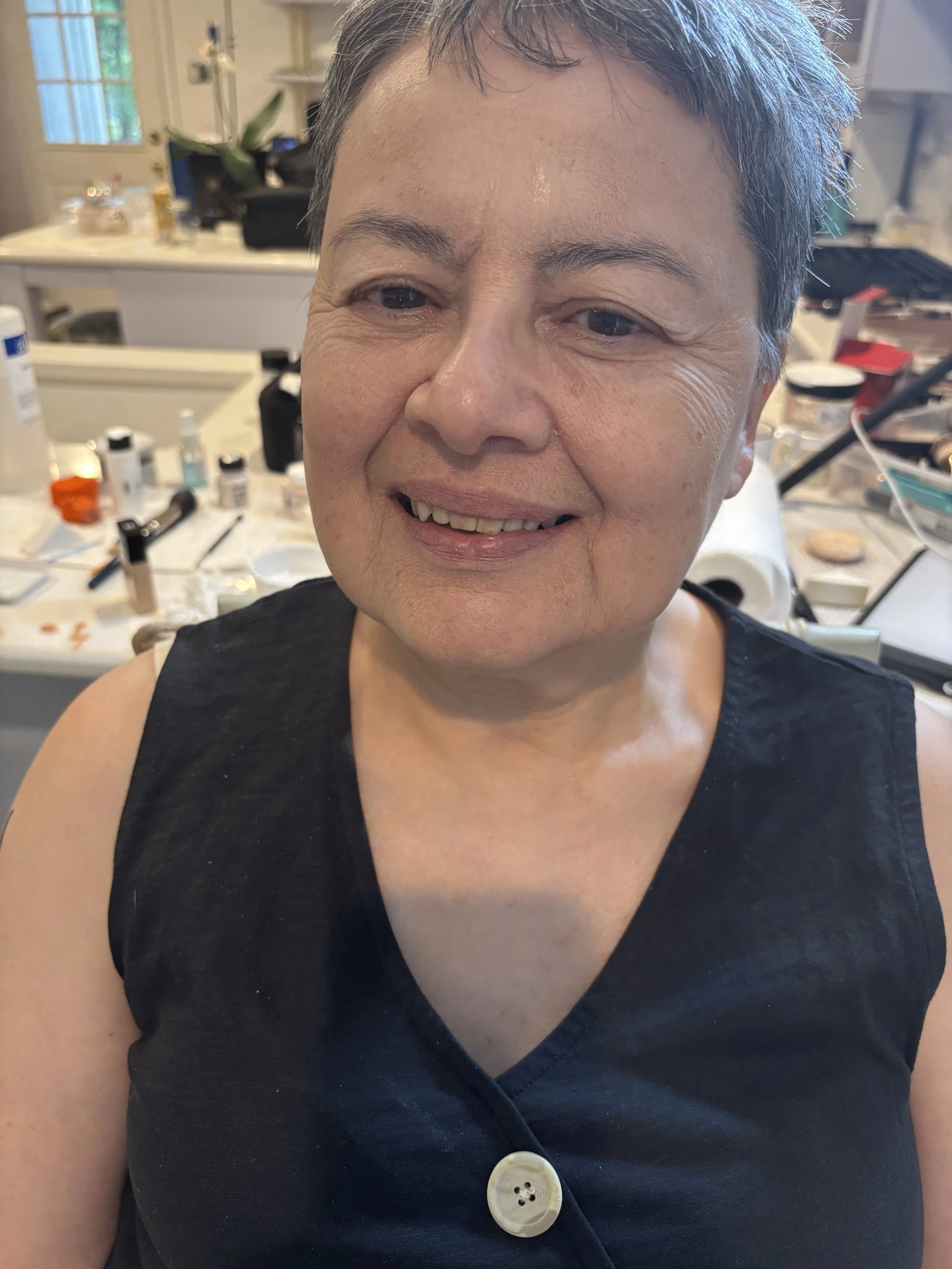 AFTER / FRONT: Aging - Stretch/Stipple - Age 55 to 65