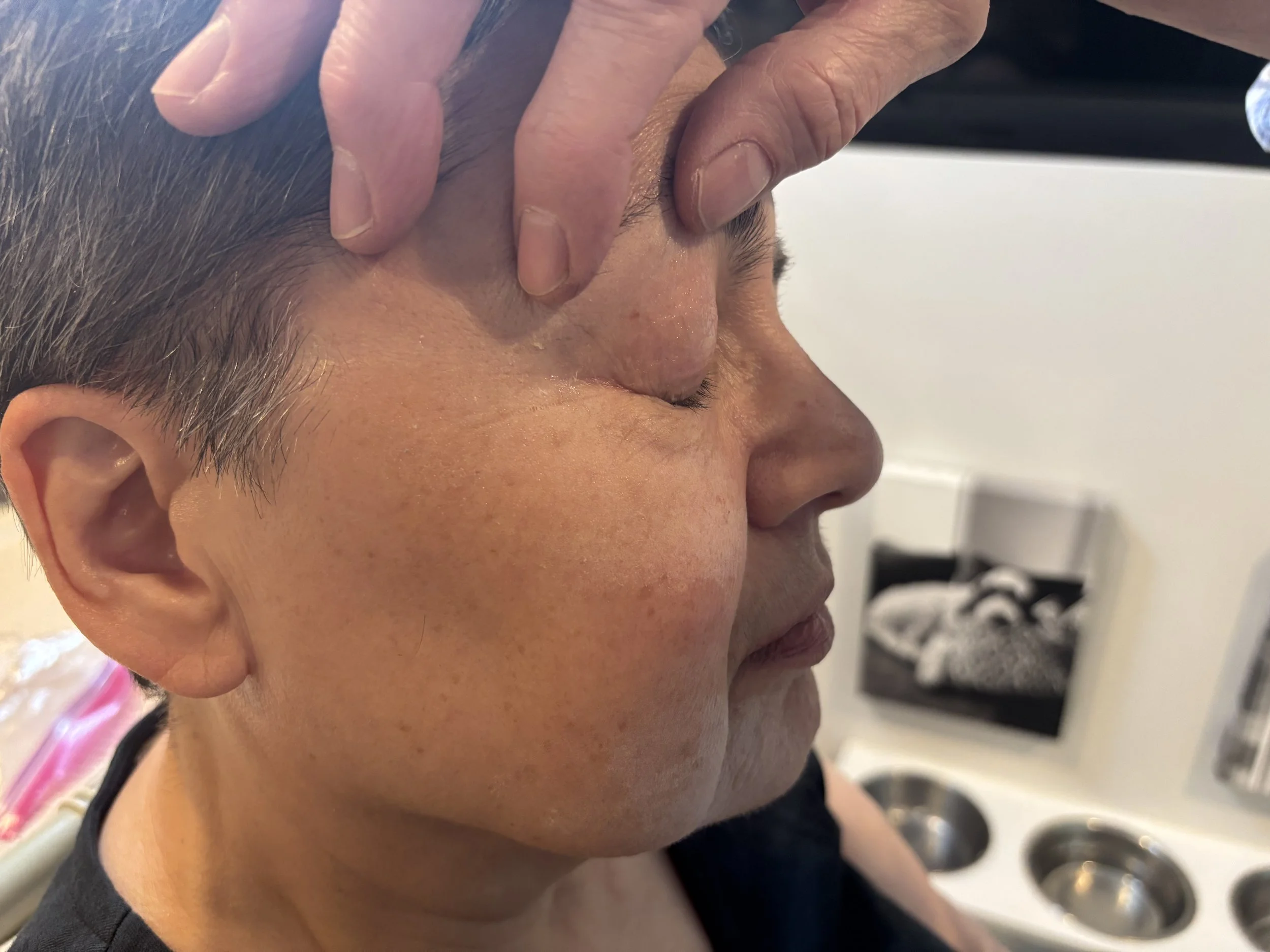 PROCESS: Aging - Stretch/Stipple - Age 55 to 65