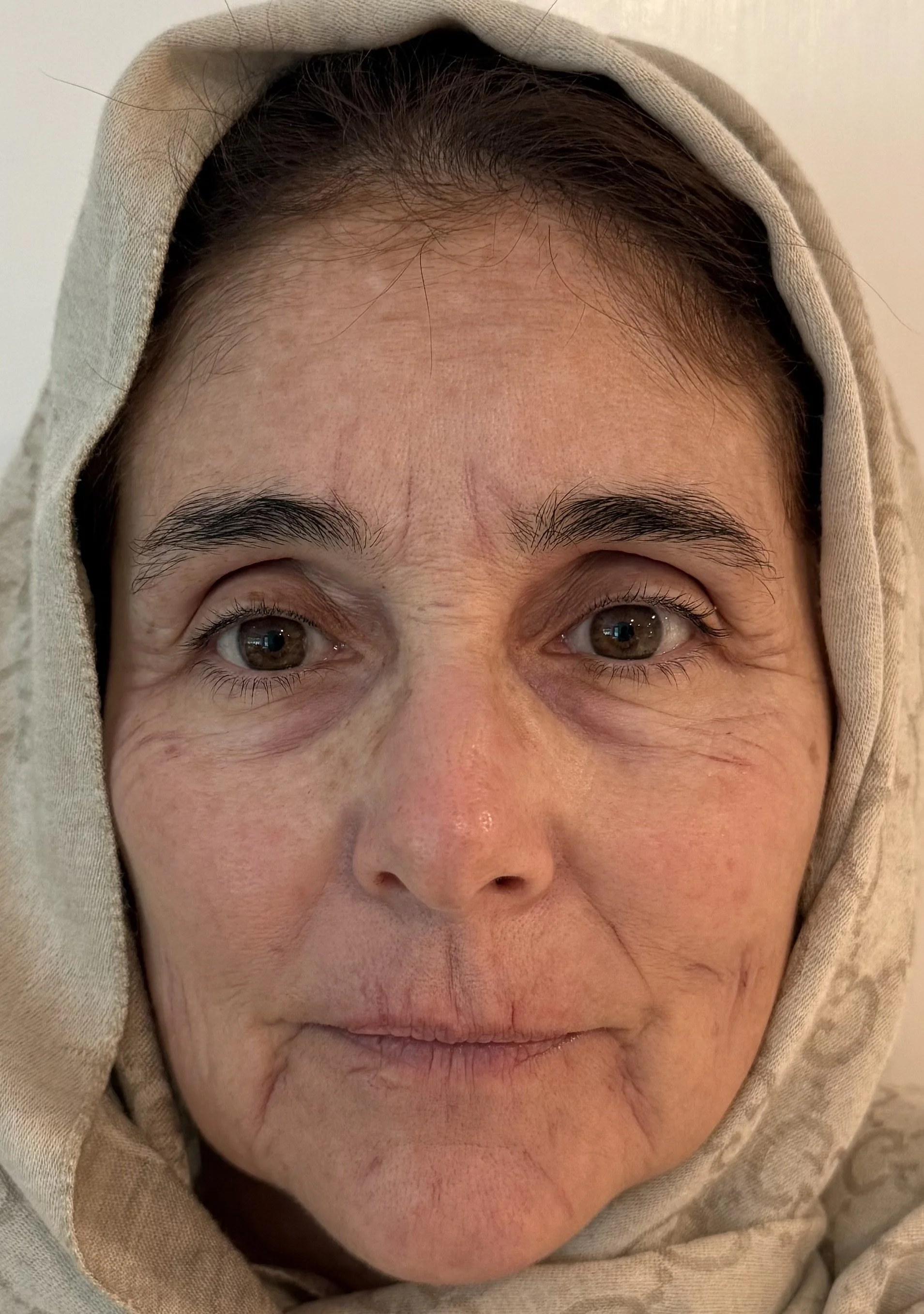 AFTER / FRONT: Aging - Highlight/Shadow