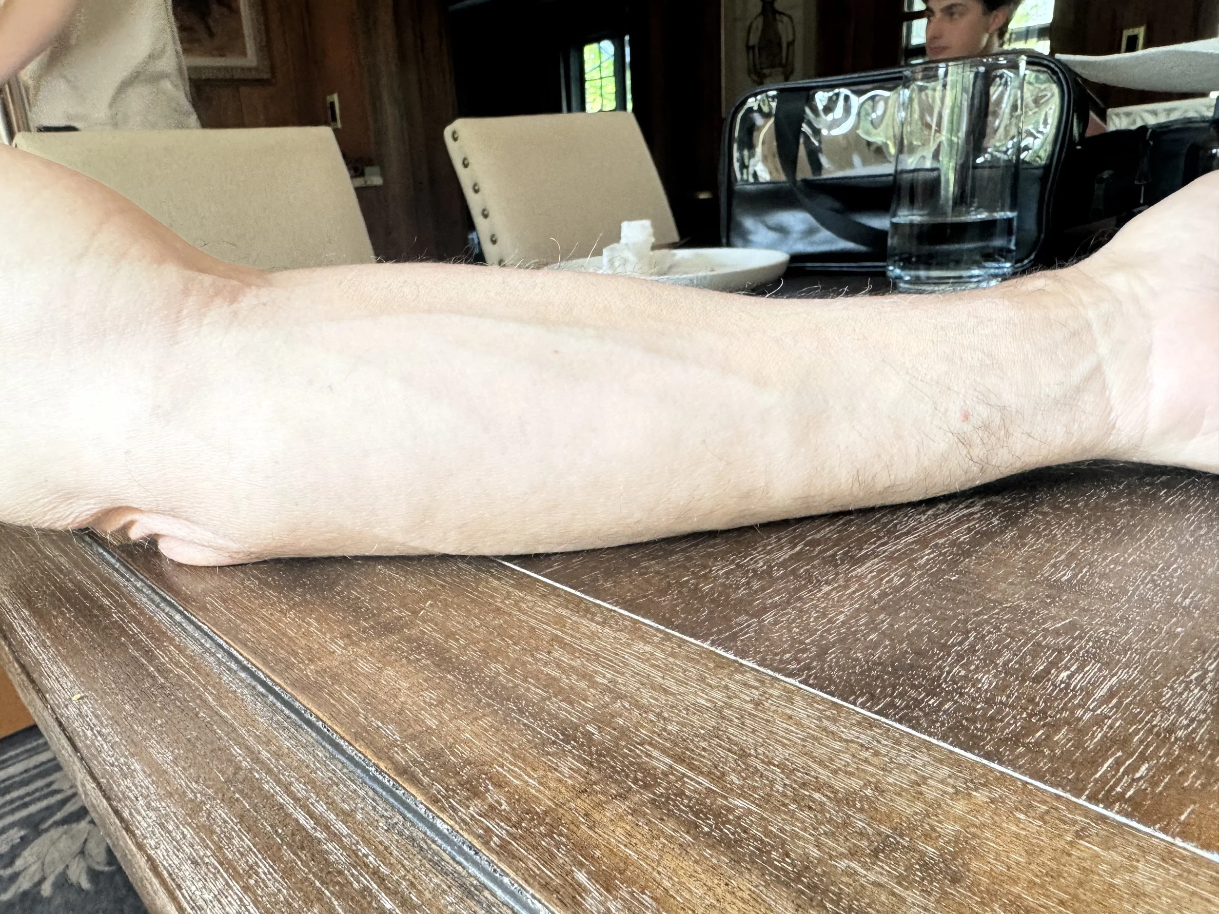 AFTER: Tattoos - Coverage