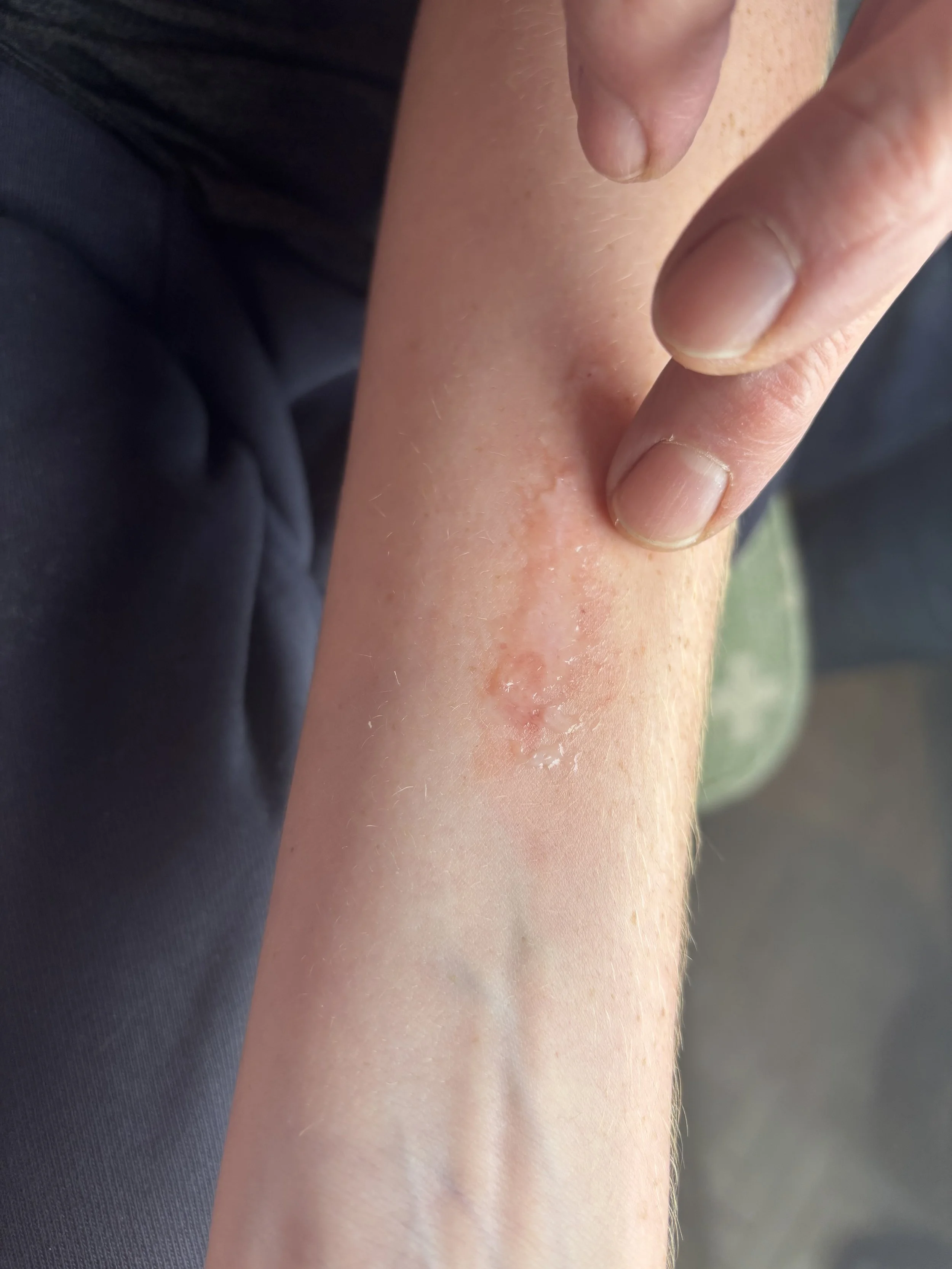 PROCESS: Basic FX - Burn