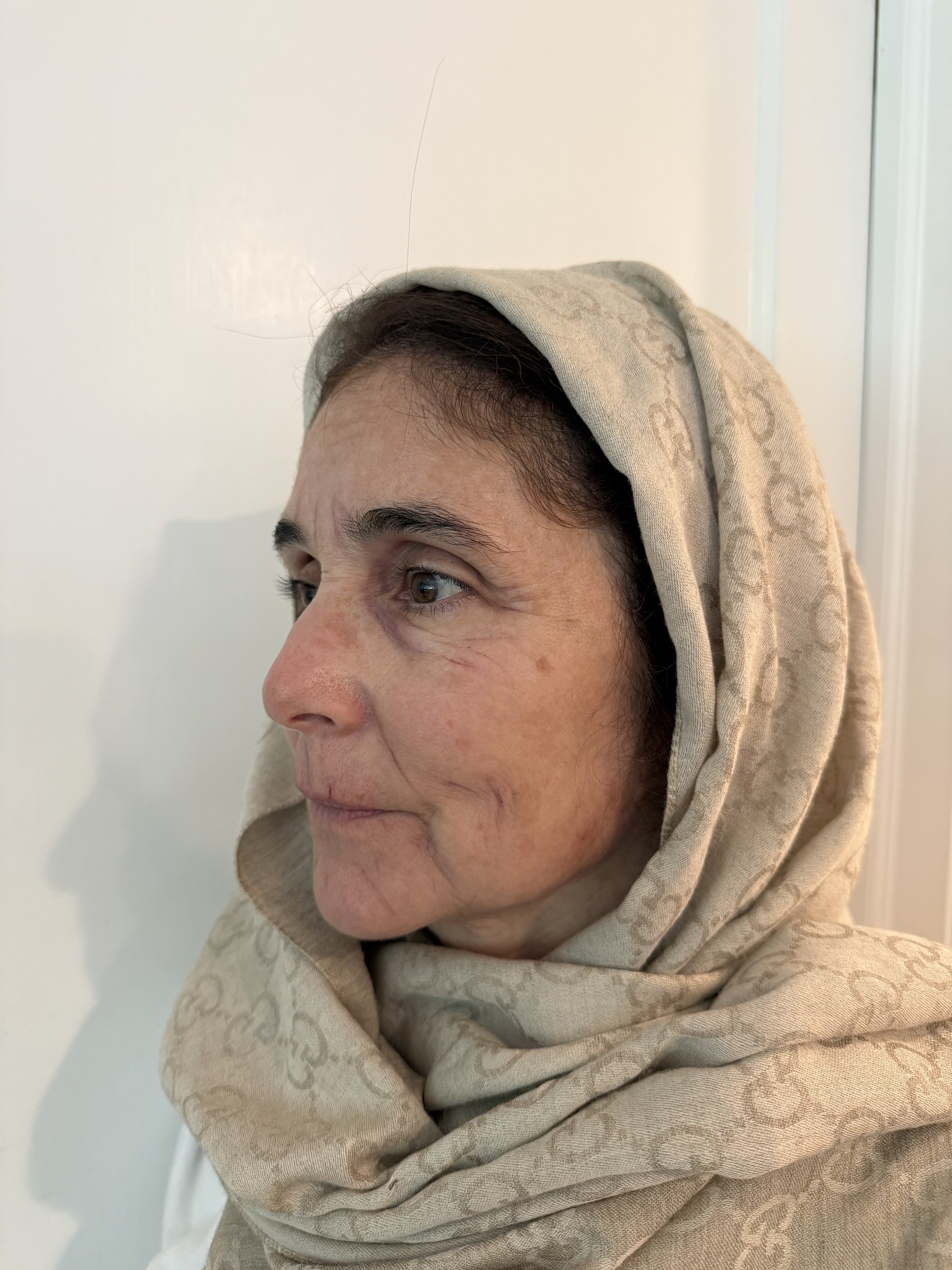AFTER / LEFT: Aging - Highlight/Shadow