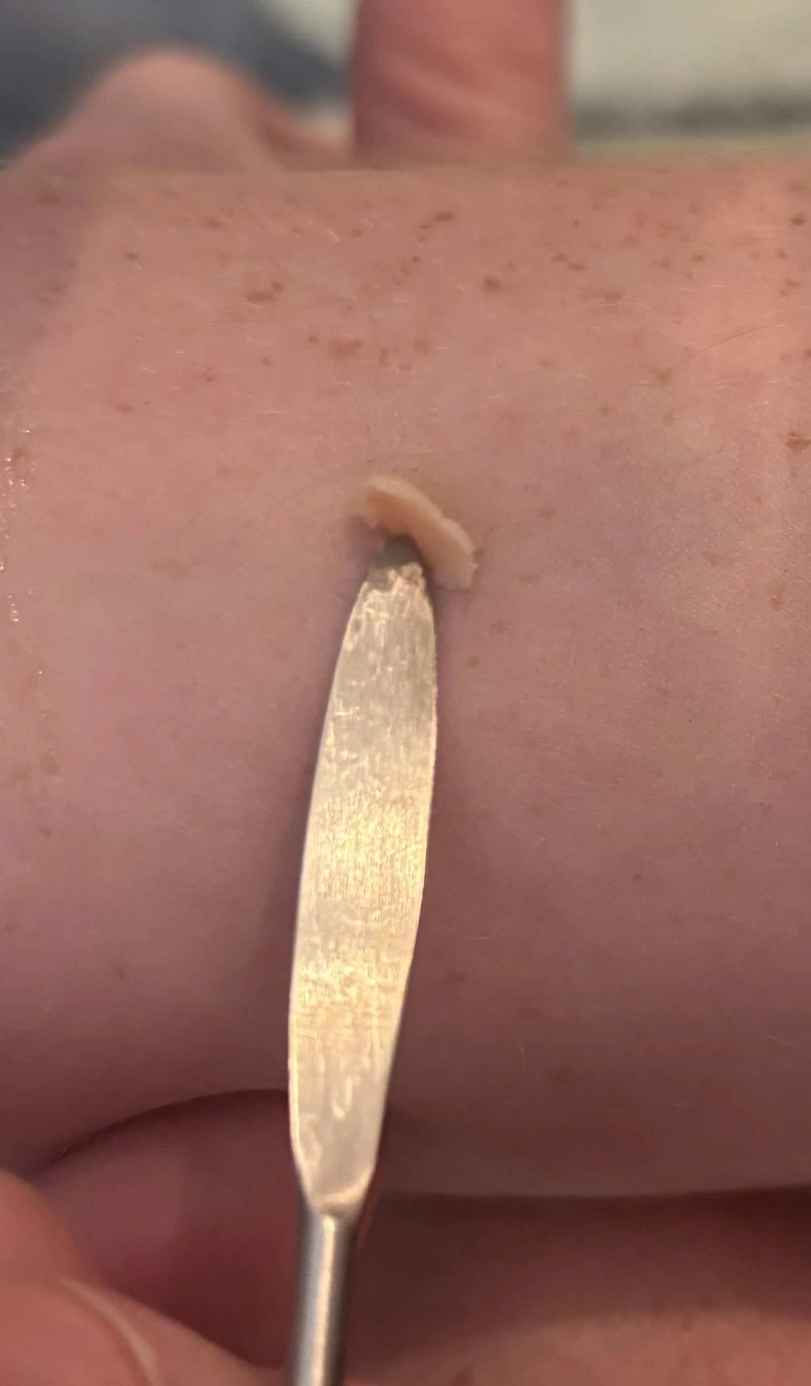 PROCESS: Basic FX - Scar 2