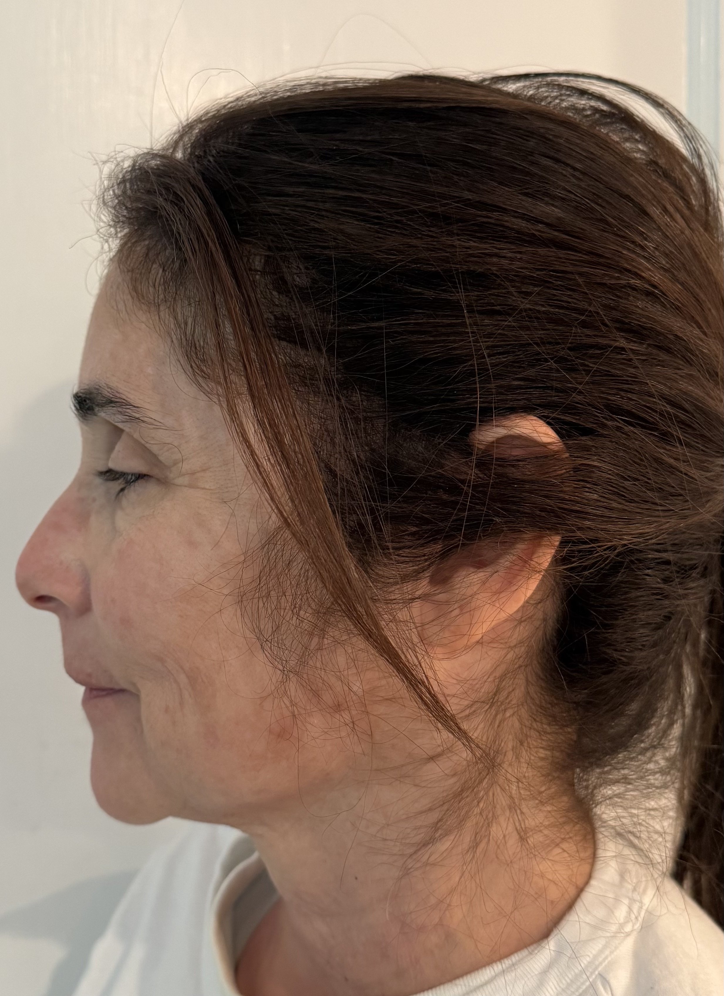 BEFORE: Aging - Highlight/Shadow