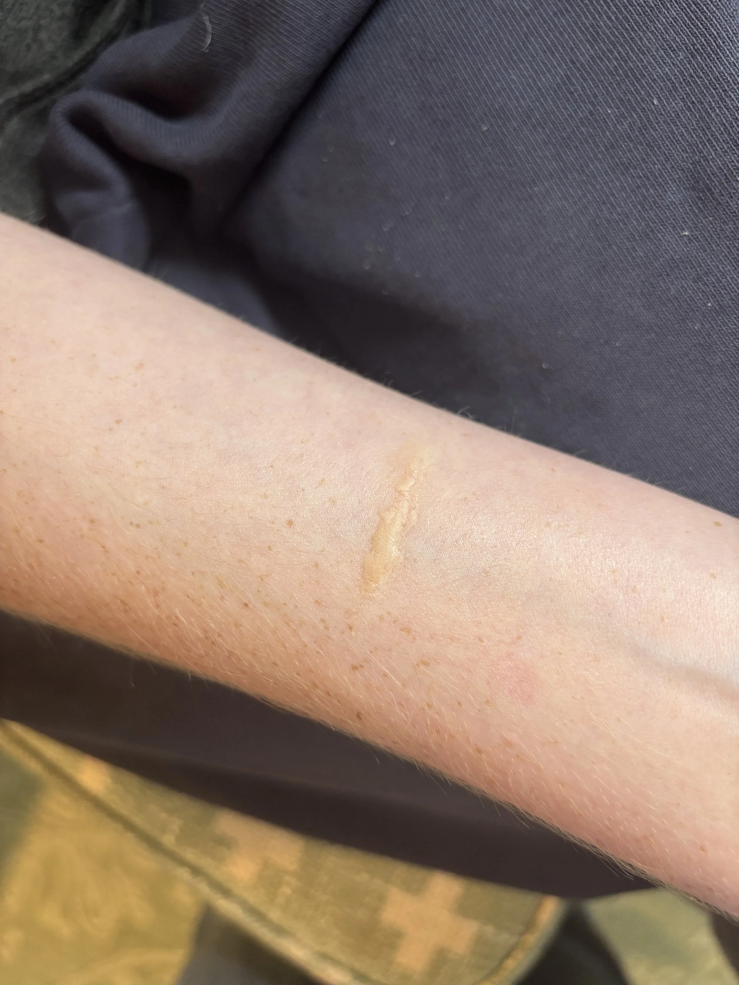 AFTER: Basic FX - Scar 2