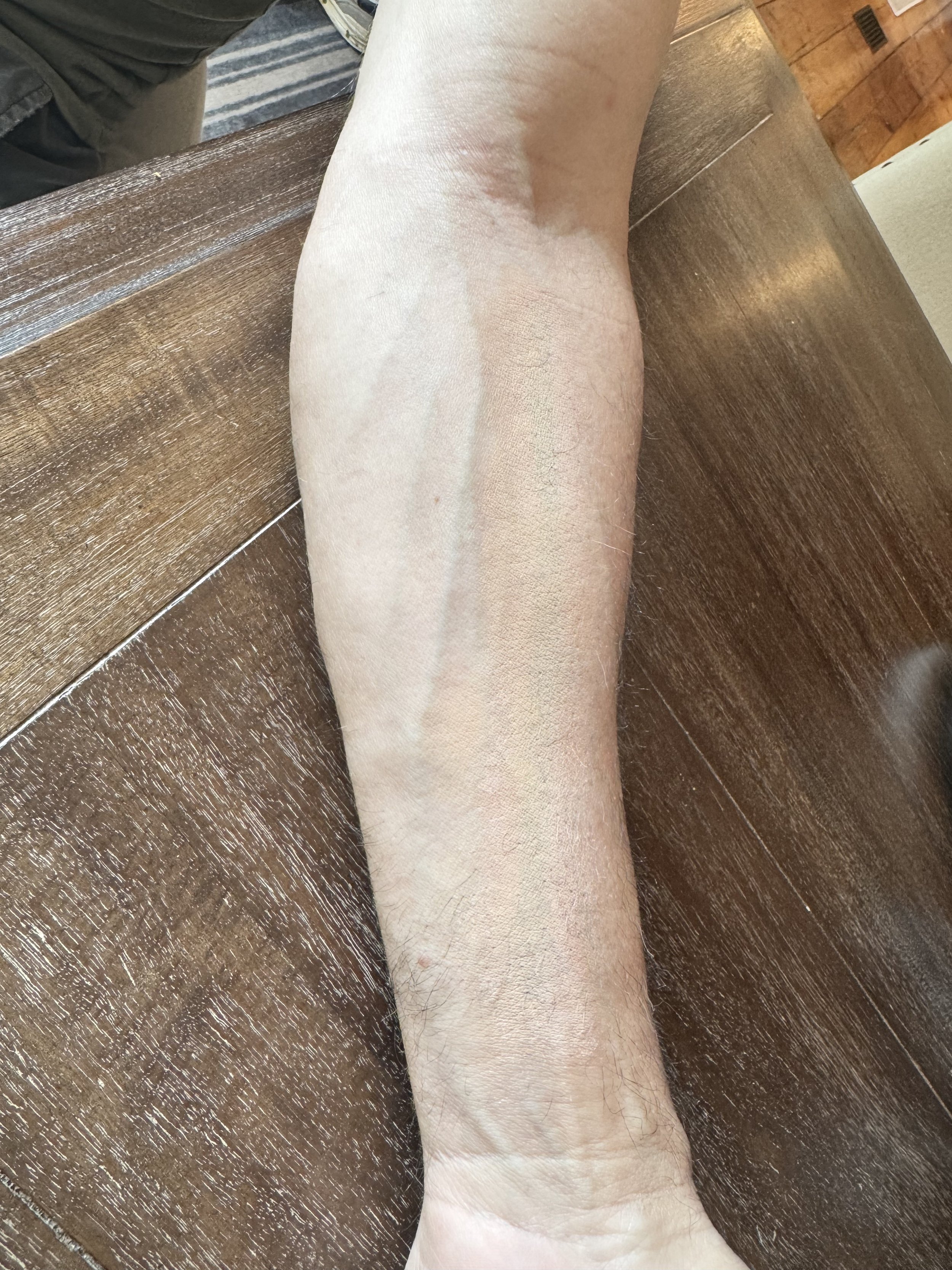 AFTER: Tattoos - Coverage