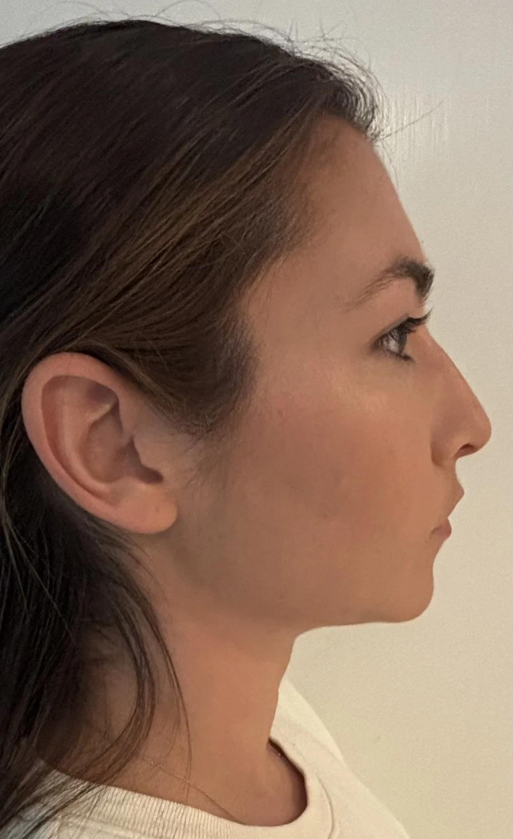 AFTER / RIGHT: Straight & Corrective - Look 1