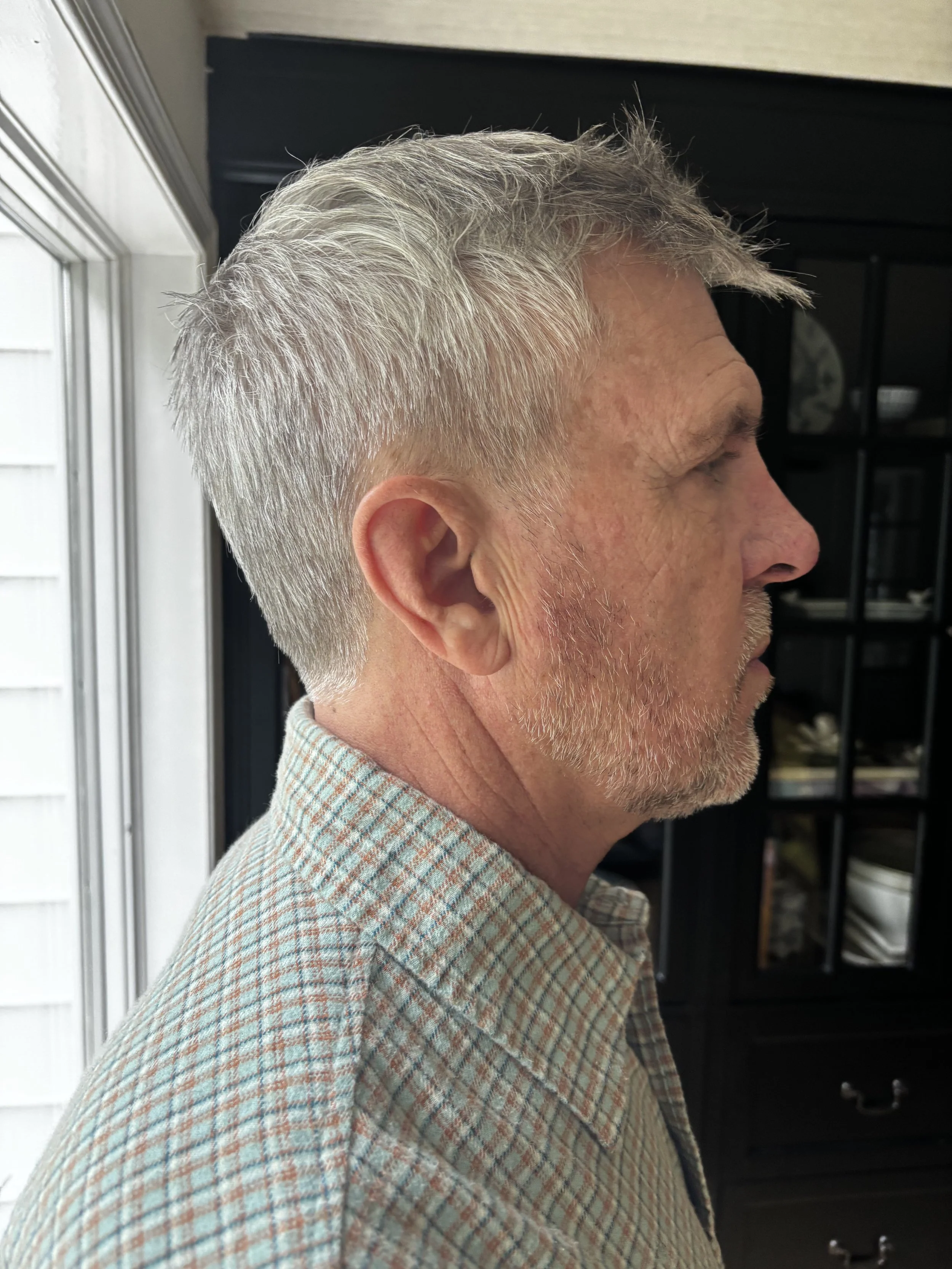 BEFORE: Facial Hair - Lace Piece Application