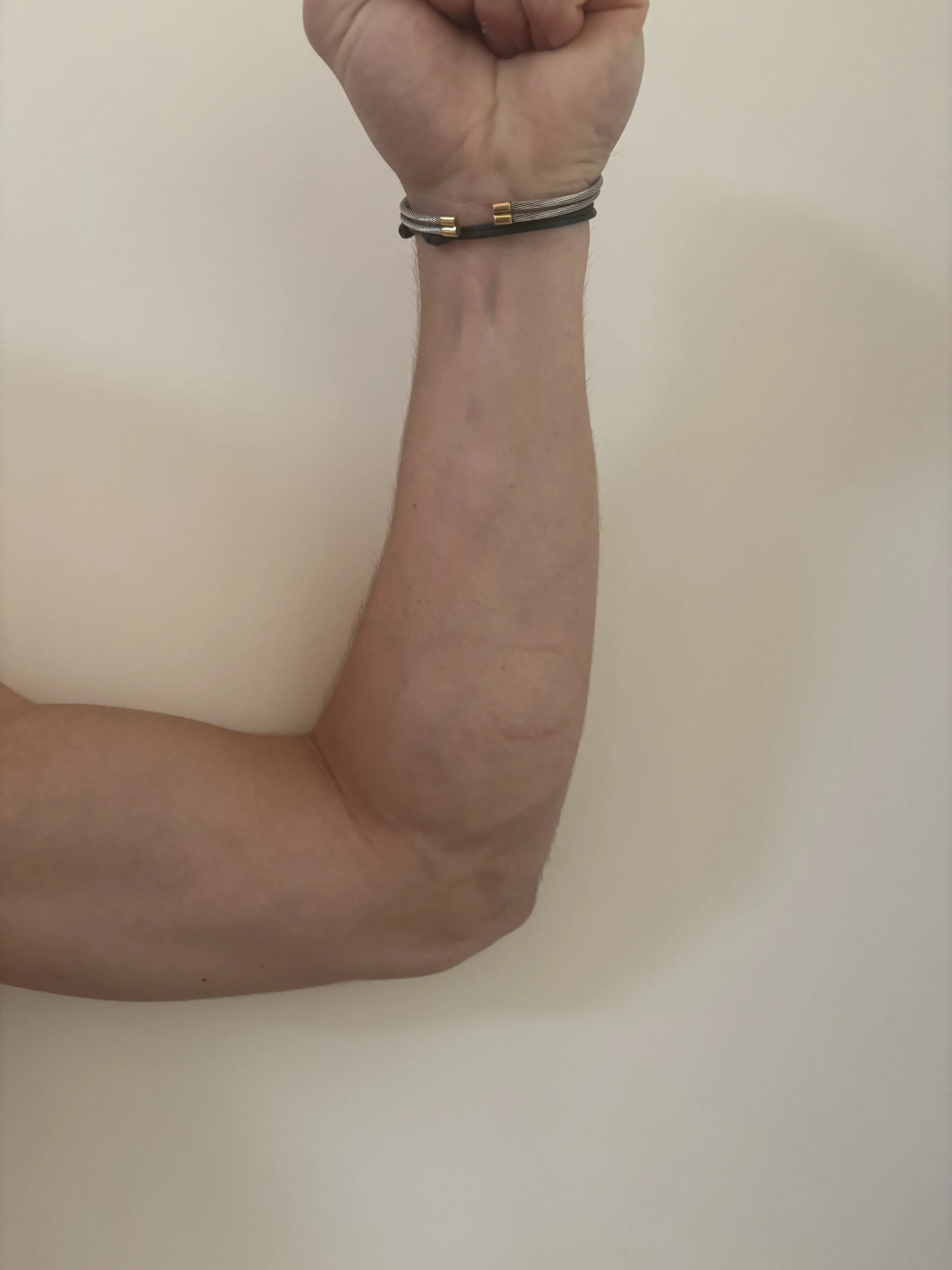 BEFORE: Basic FX - Bruise