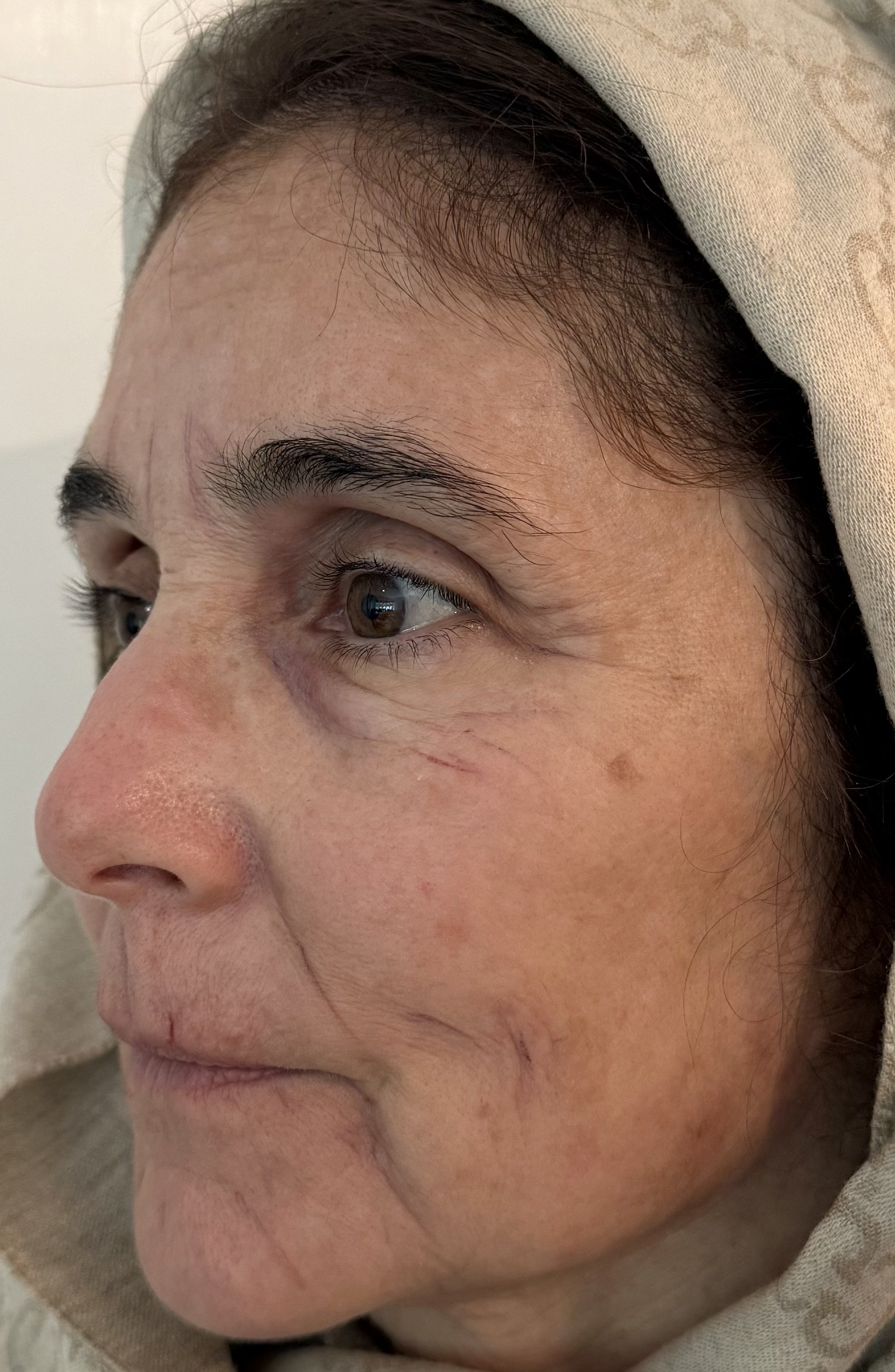 AFTER / LEFT: Aging - Highlight/Shadow
