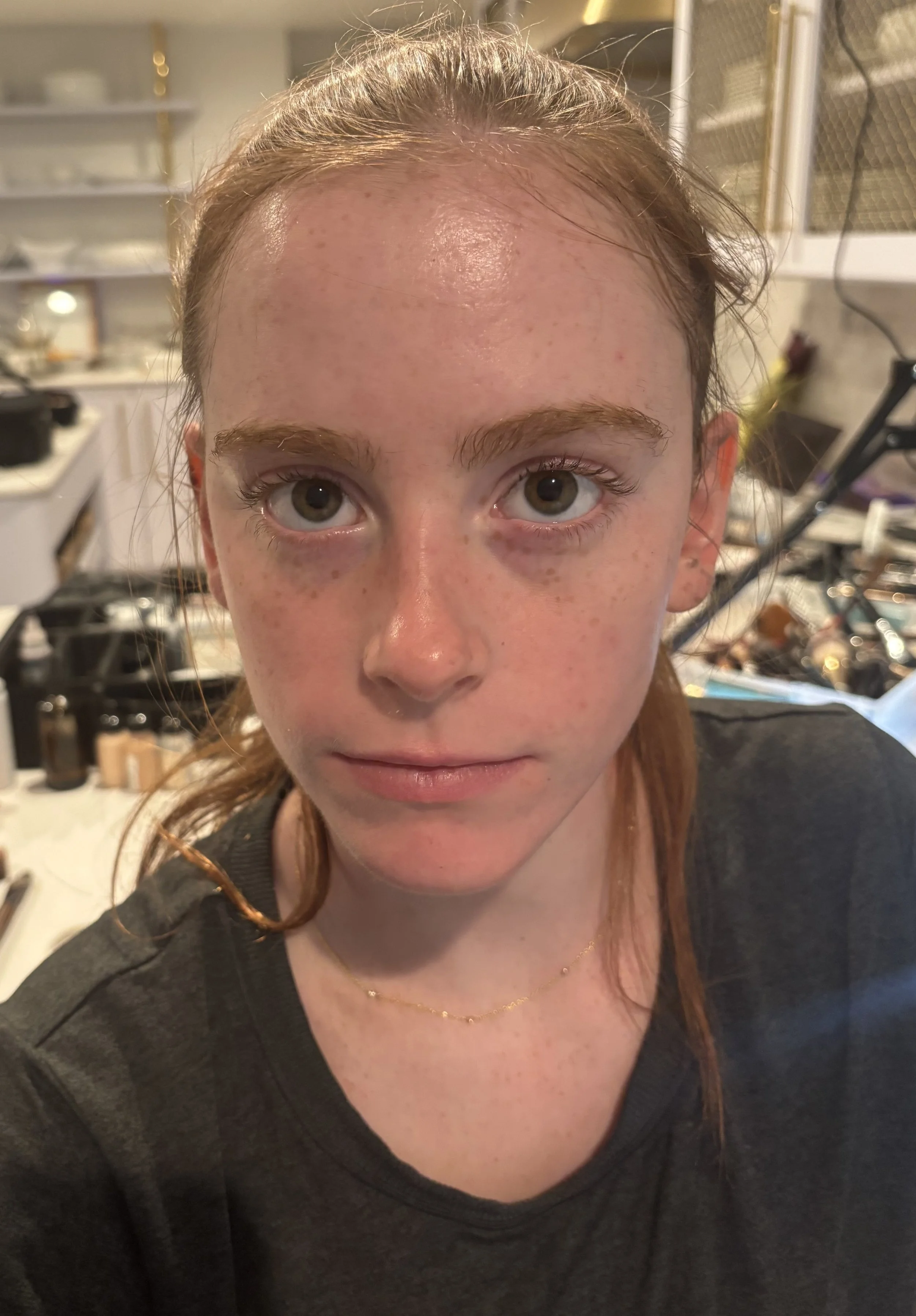 BEFORE: Basic FX - Scab