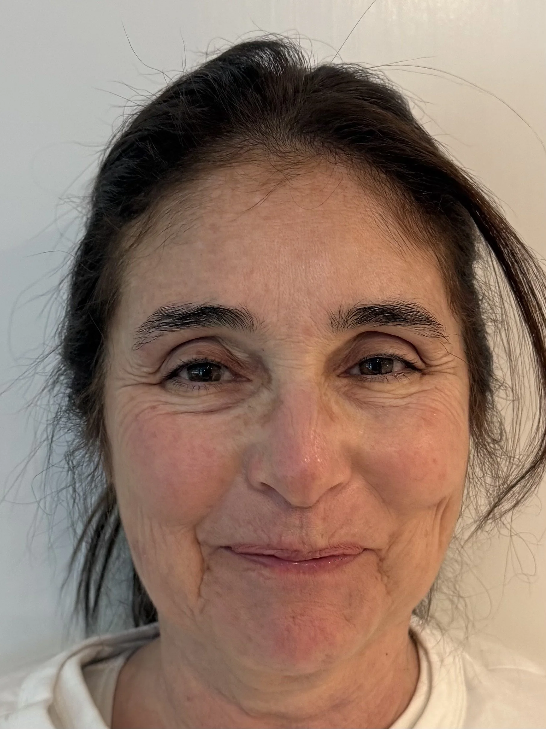 BEFORE: Aging - Highlight/Shadow
