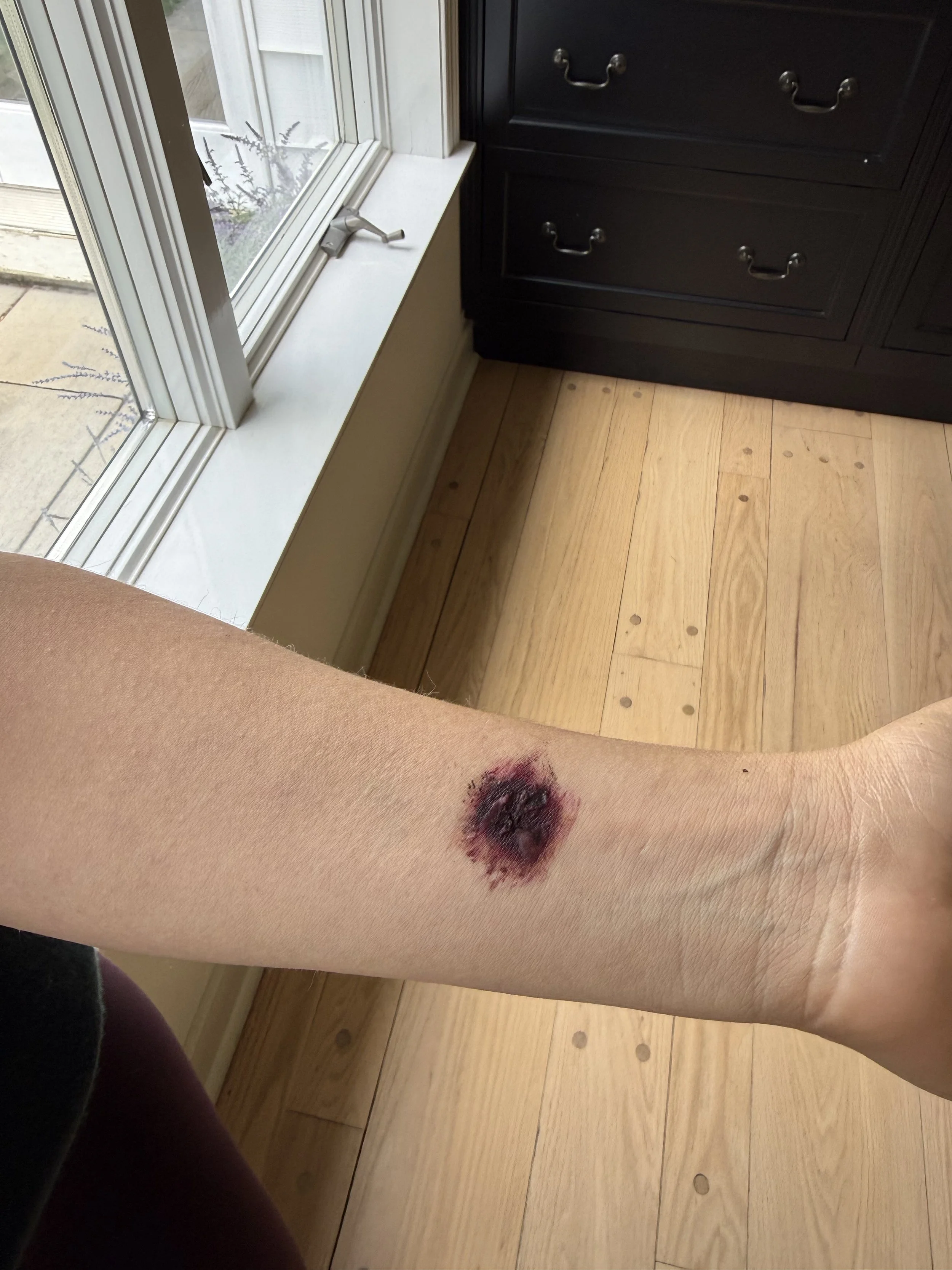 AFTER: Basic FX - Scab 1