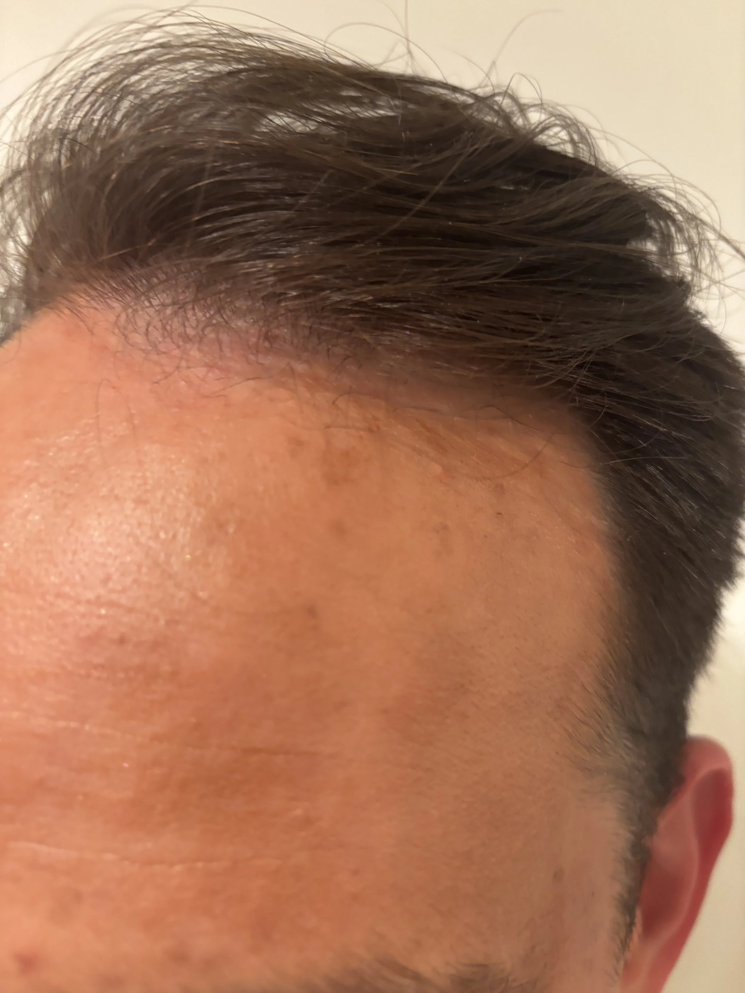 AFTER / FRONT: Distress & Weathering - Sun/Hot Weather Exposure