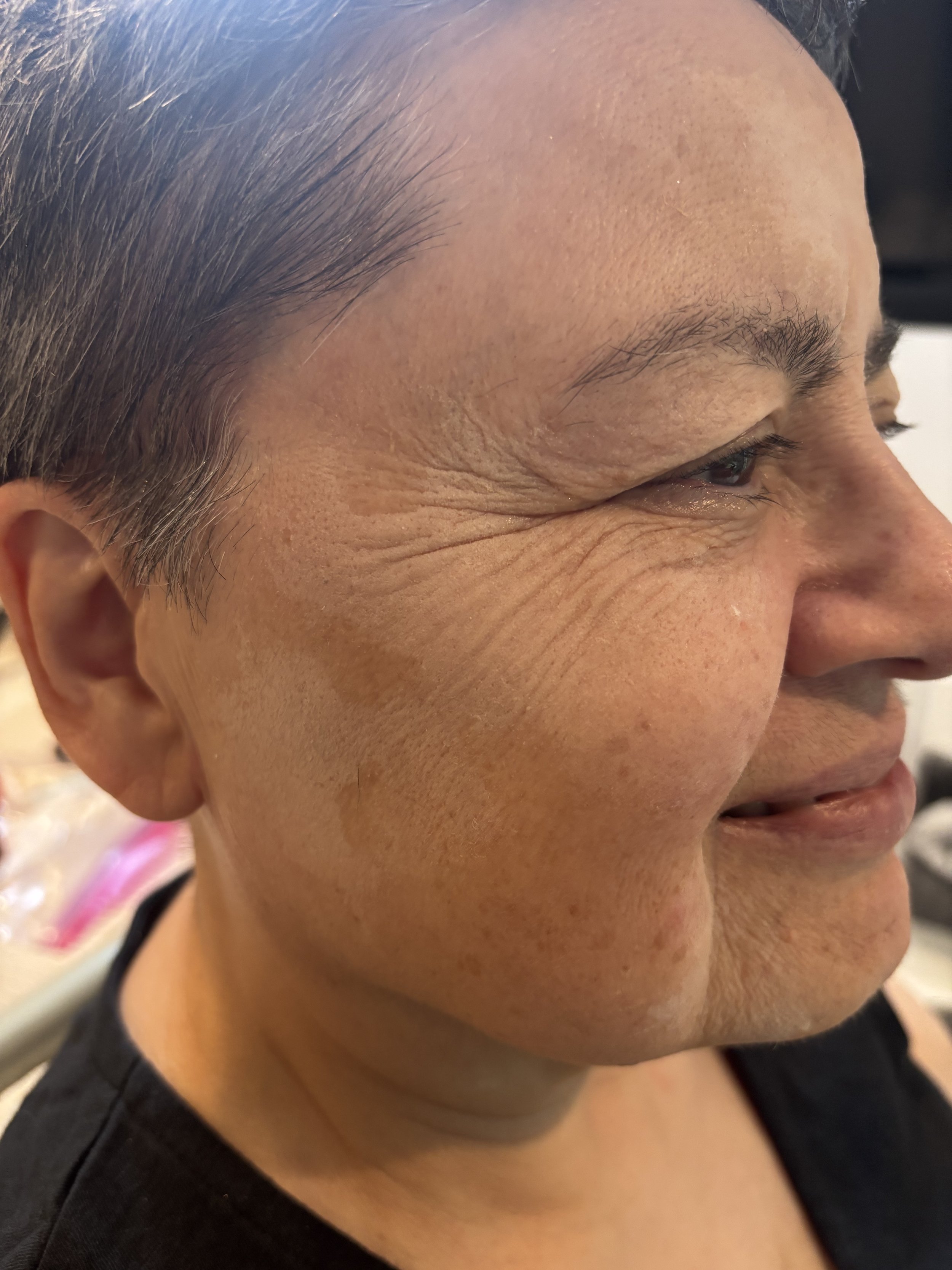 PROCESS: Aging - Stretch/Stipple - Age 55 to 65