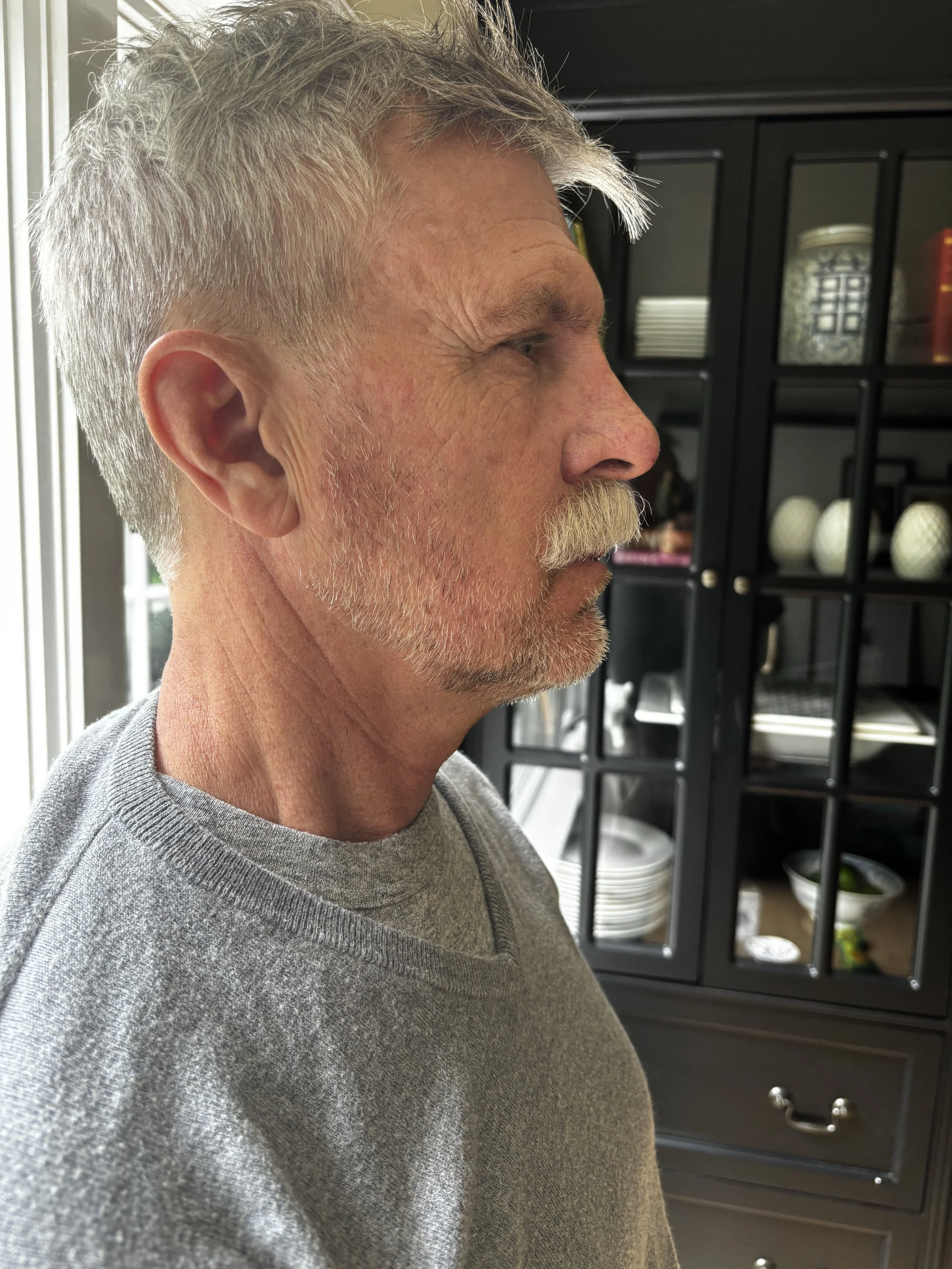 AFTER: Facial Hair - Lace Piece Application