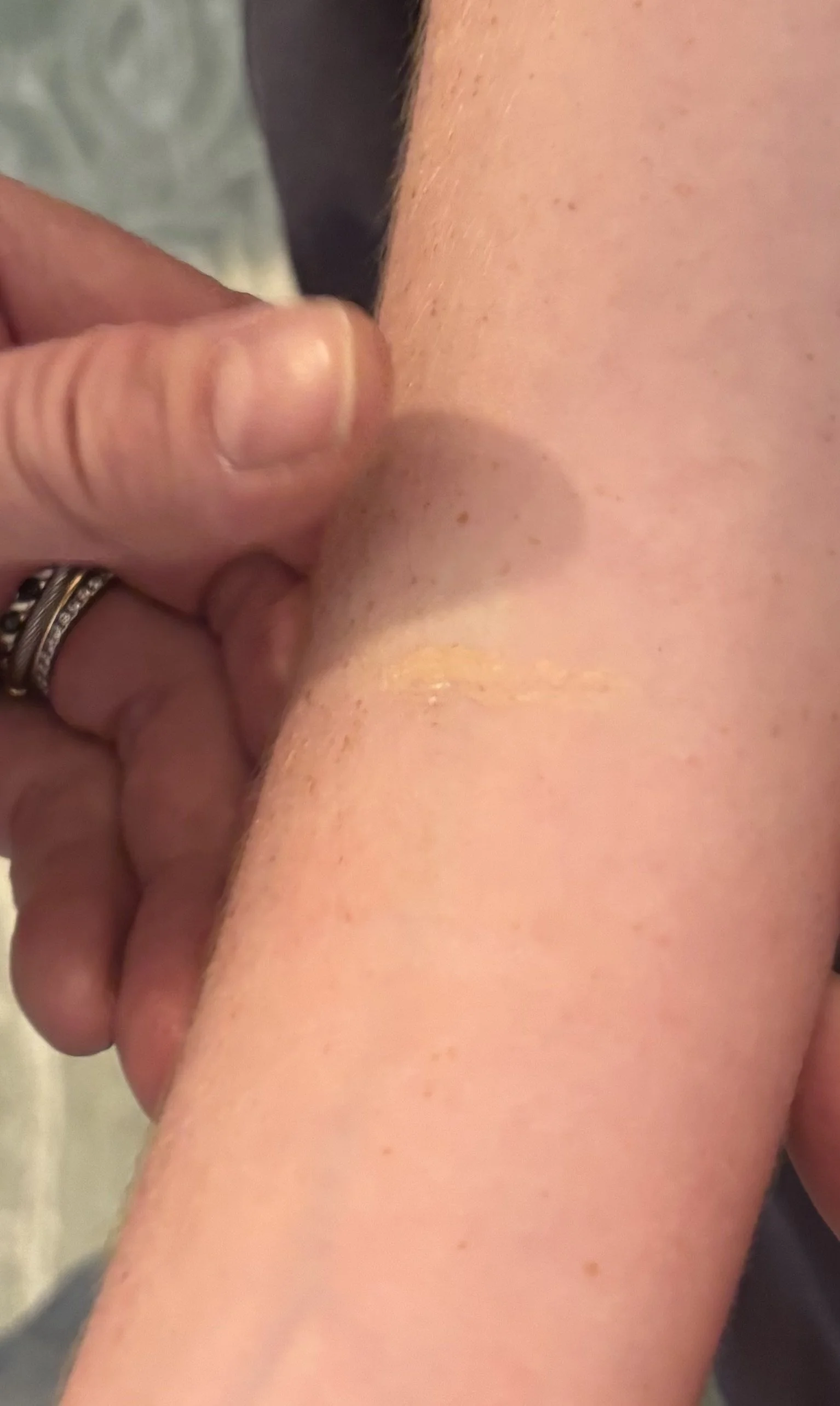 PROCESS: Basic FX - Scar 2