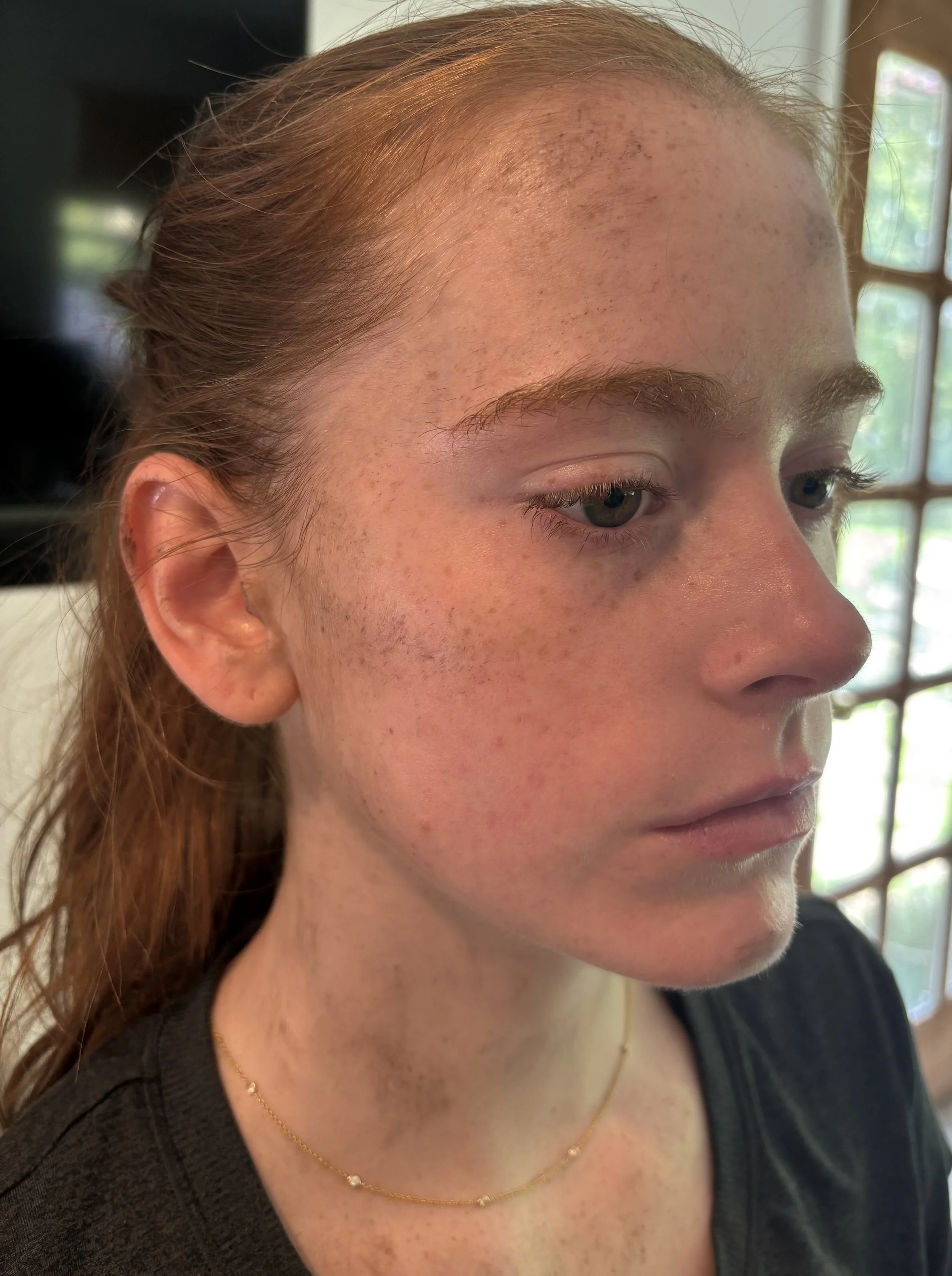 AFTER: Basic FX - Dirt