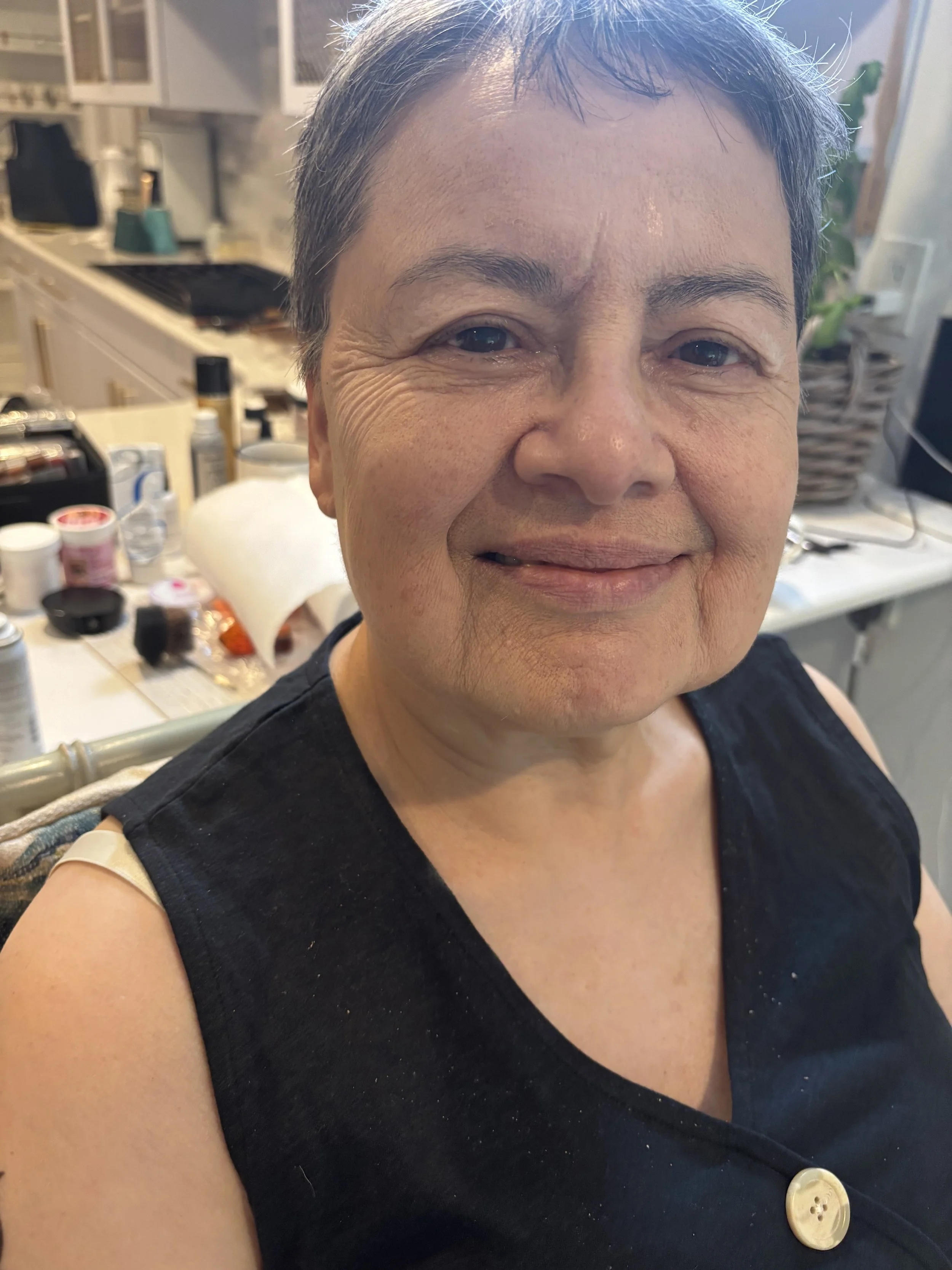 AFTER / FRONT: Aging - Stretch/Stipple - Age 55 to 65