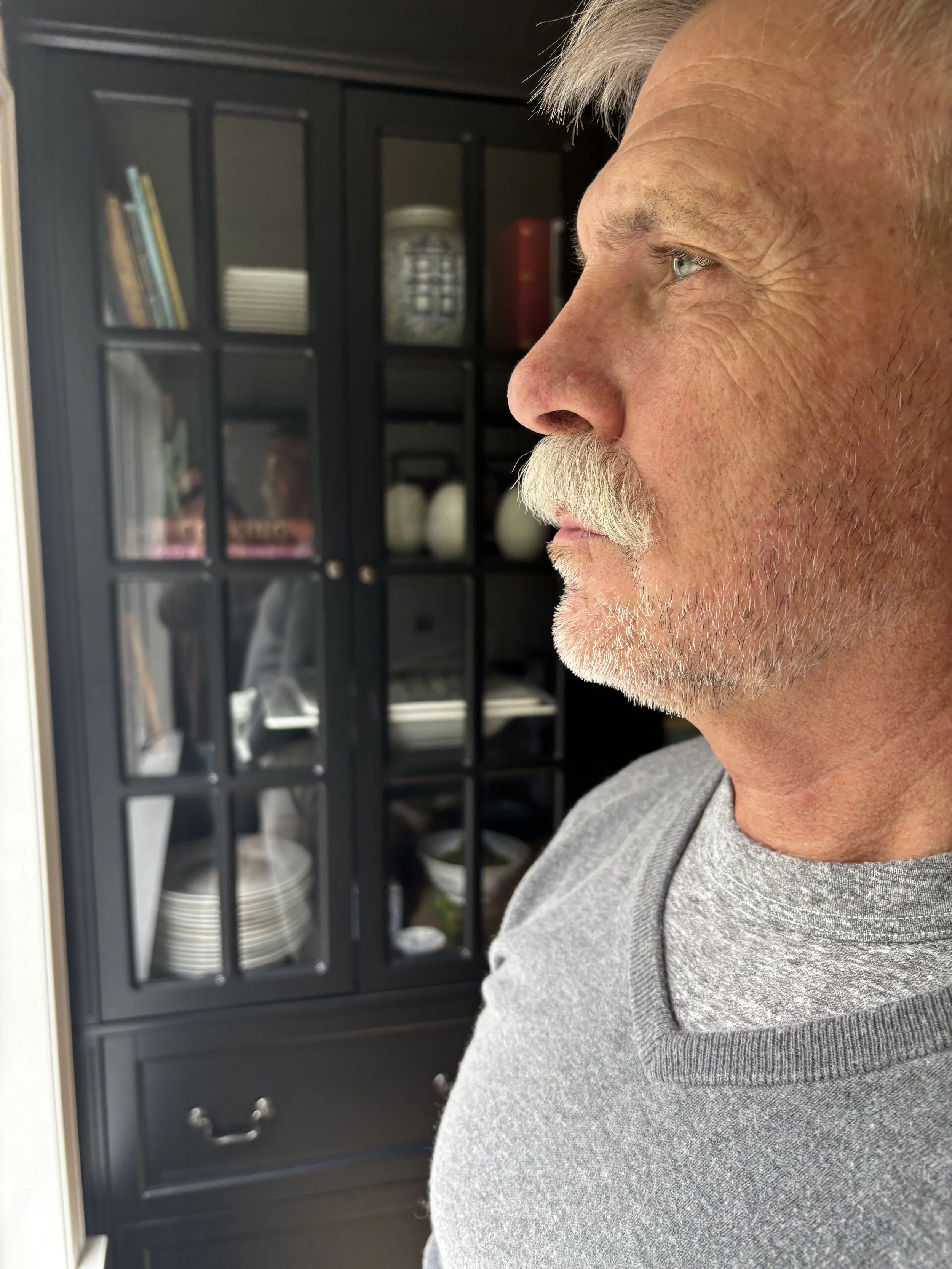 AFTER: Facial Hair - Lace Piece Application
