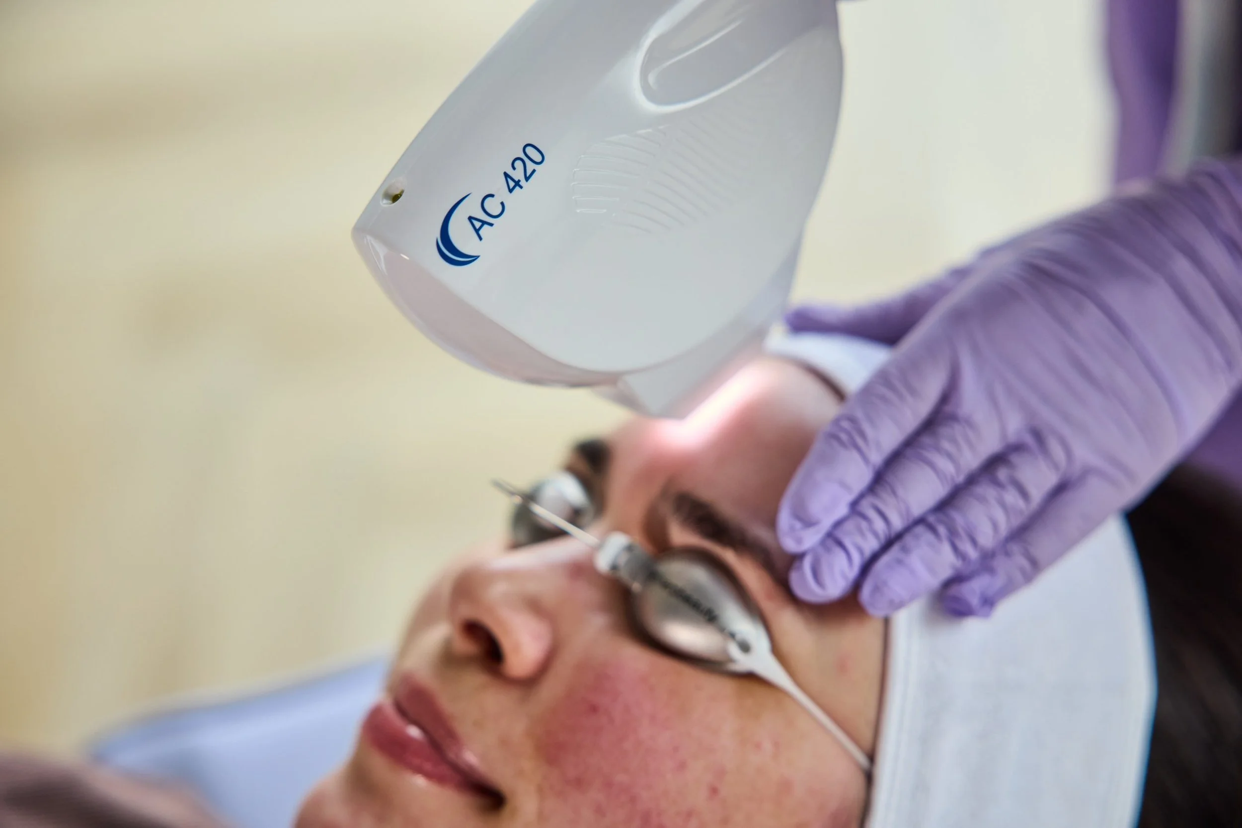 Close-up of a person receiving an injection in their forehead with a medical device labeled AC 420, wearing glasses and a surgical mask pulled down, with a healthcare worker wearing purple gloves holding the device.