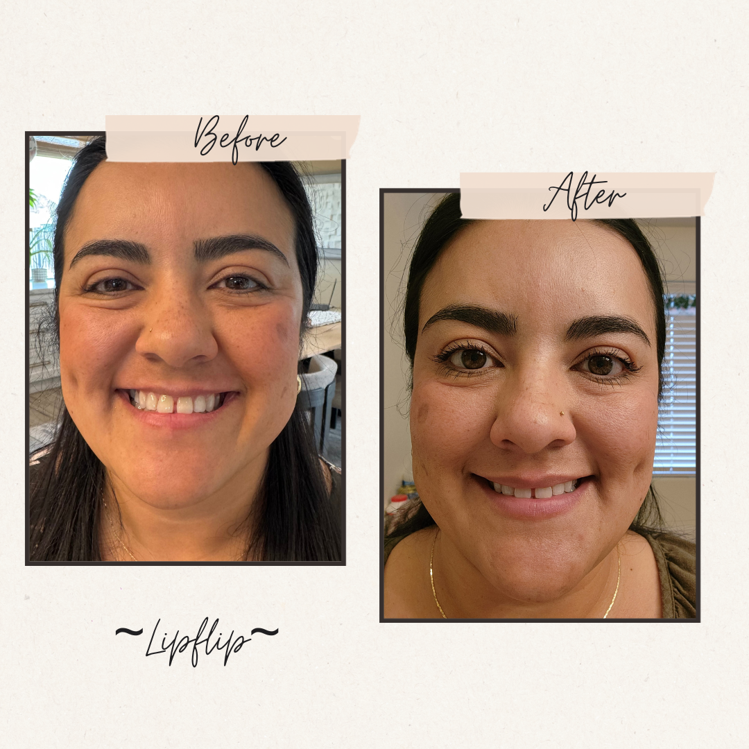 Chandler, AZ, 85286, Med Spa services Near Me
