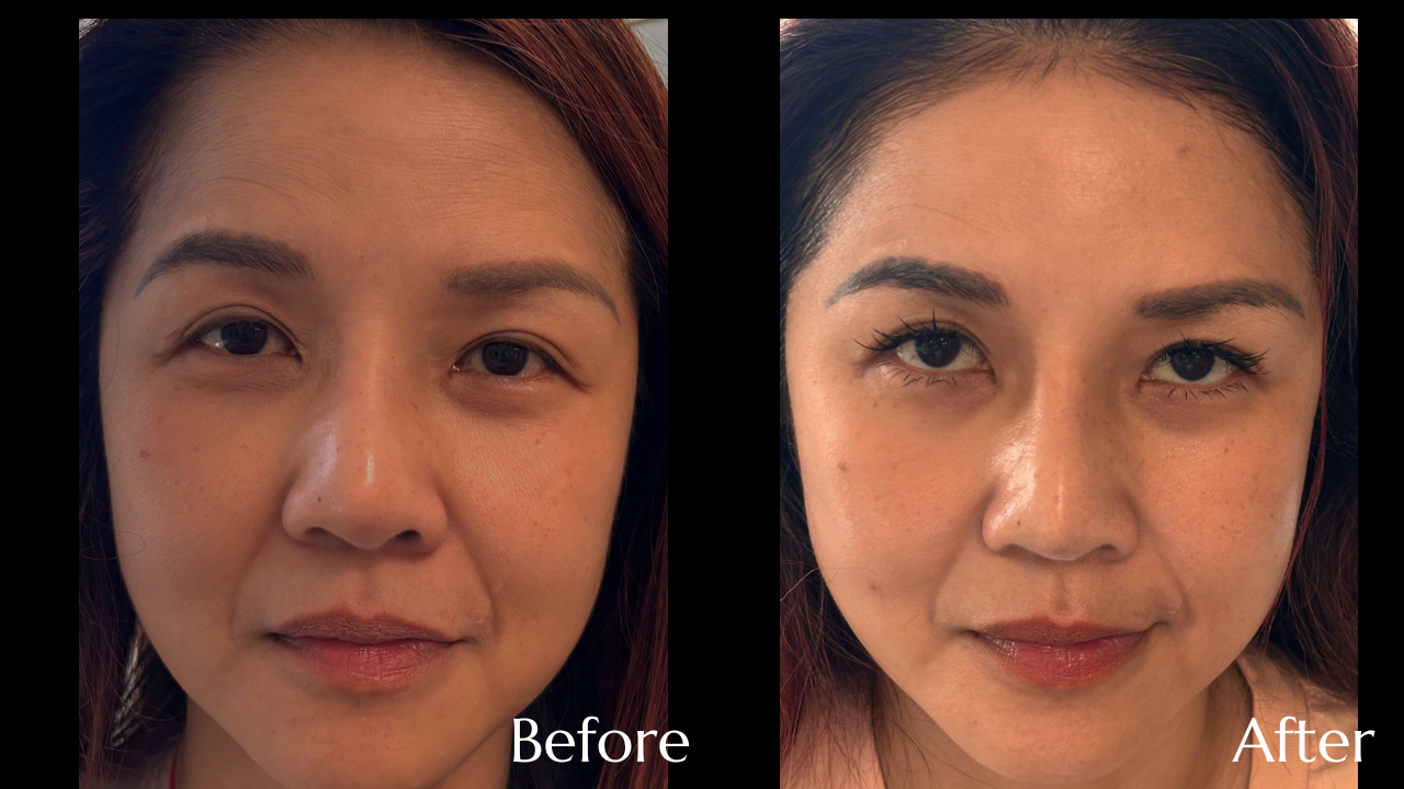 When Good Skin Still Looks Tired
