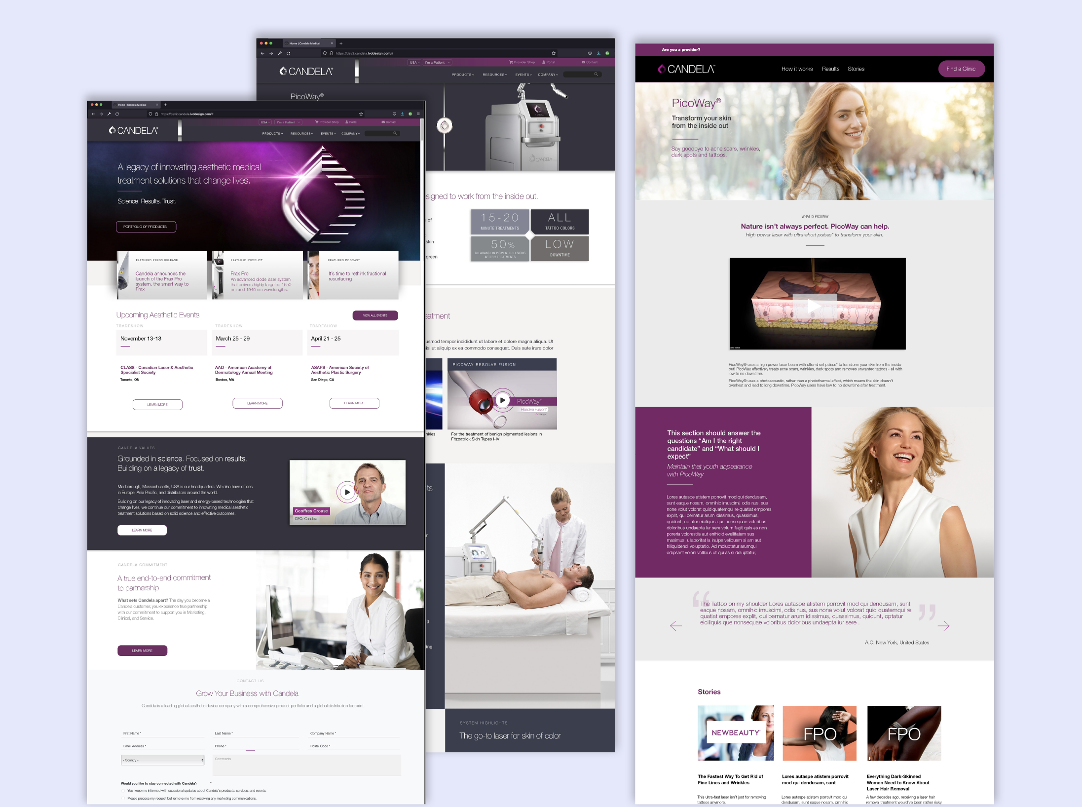 Collage of web pages for Candela Medical, a medical aesthetic company, showing products, services, and a woman with blonde hair smiling outdoors.