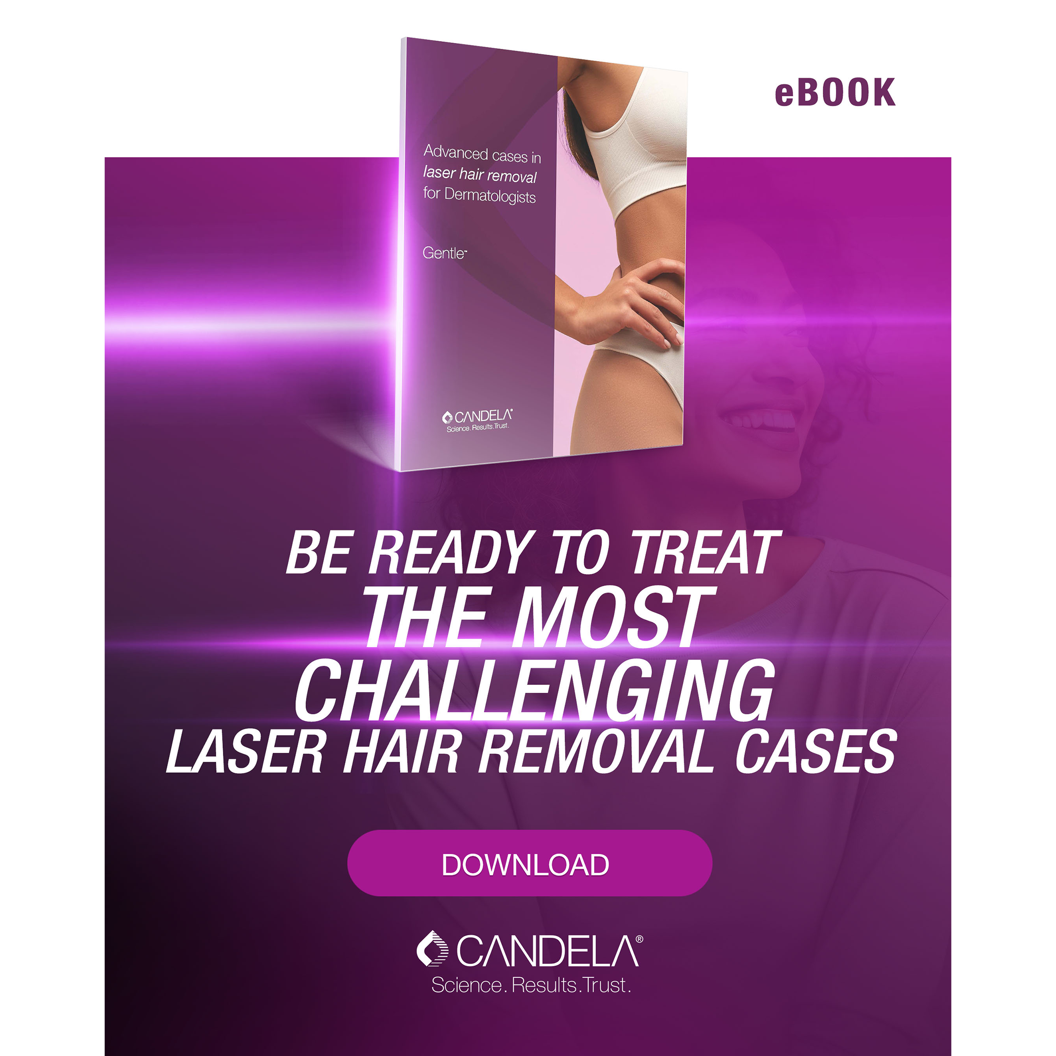 GentleMax ebook Promotion
