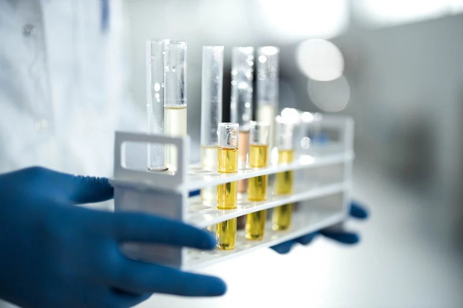 Test tubes with yellow and clear liquids in a laboratory tray, held by a gloved hand.