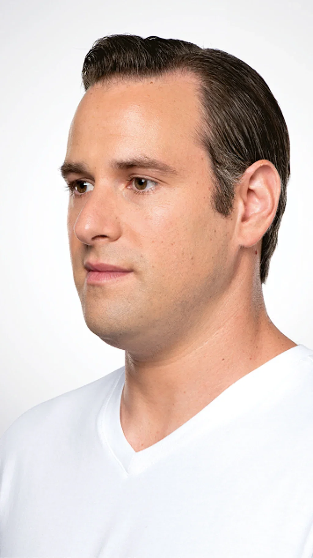 mid_treatment-jason-before-mobile_cudkc8.webp