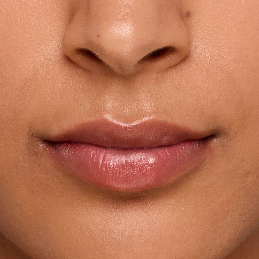 Dermal Fillers
