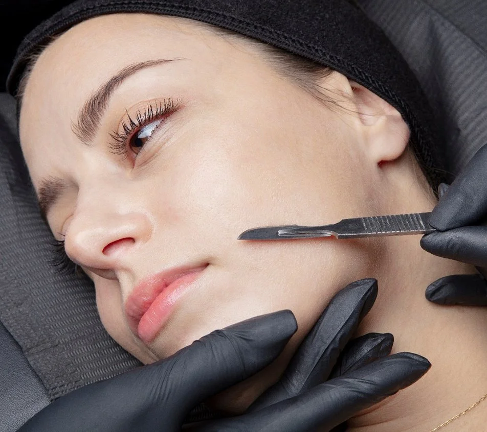 FACIAL CON DERMAPLANING
