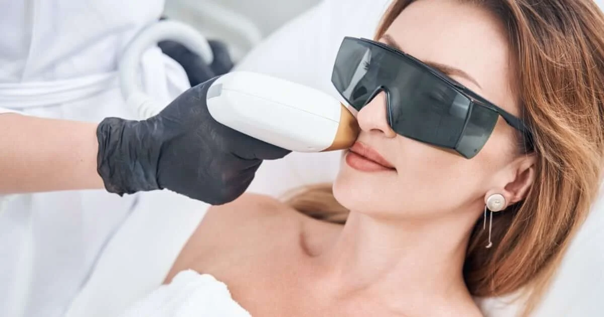 DEPILACIÓN LÁSER FACIAL