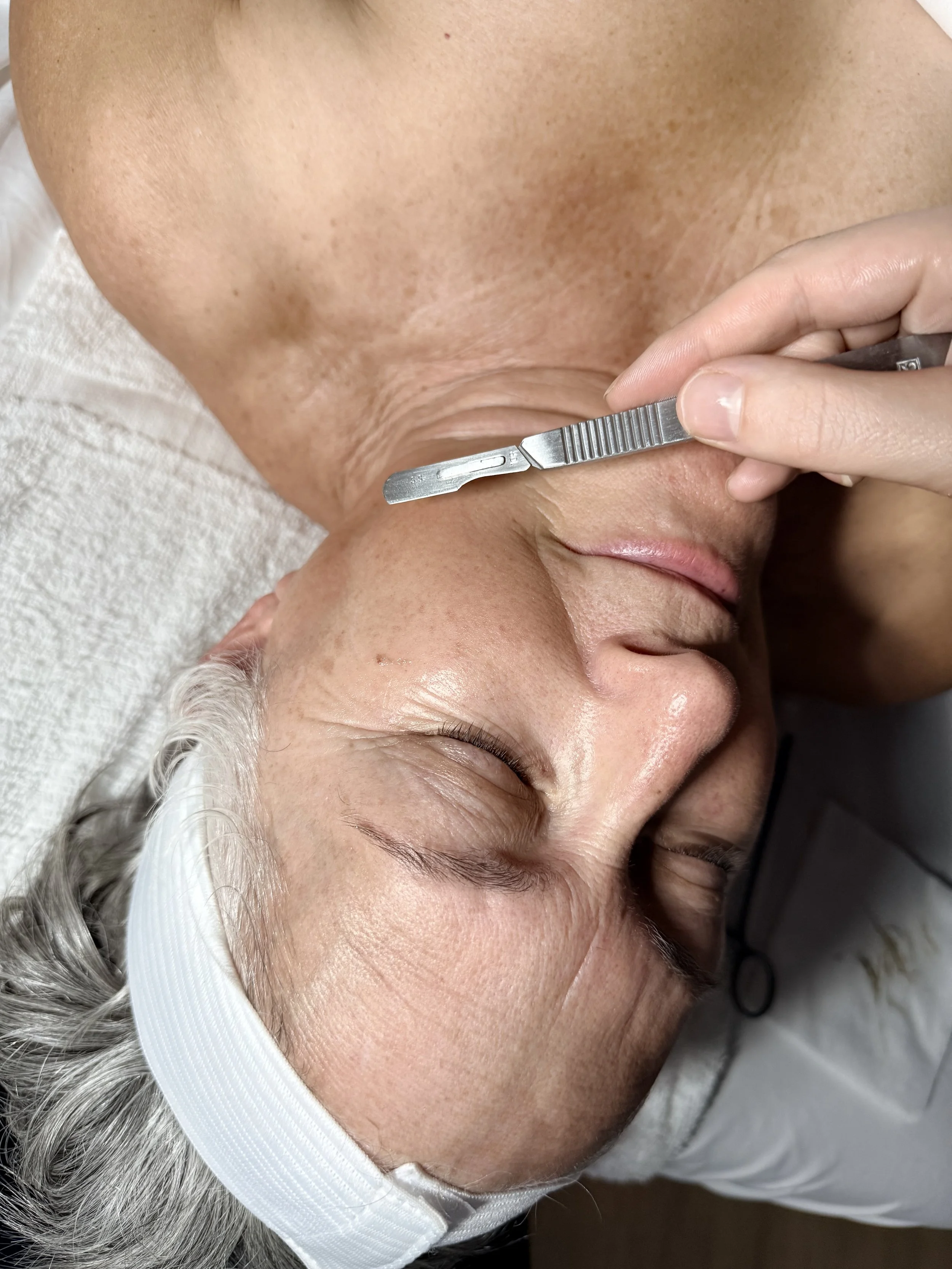 Close-up of an elderly person's face with gray hair, lying down with eyes closed, receiving a facial skin treatment with a small metal extraction tool.