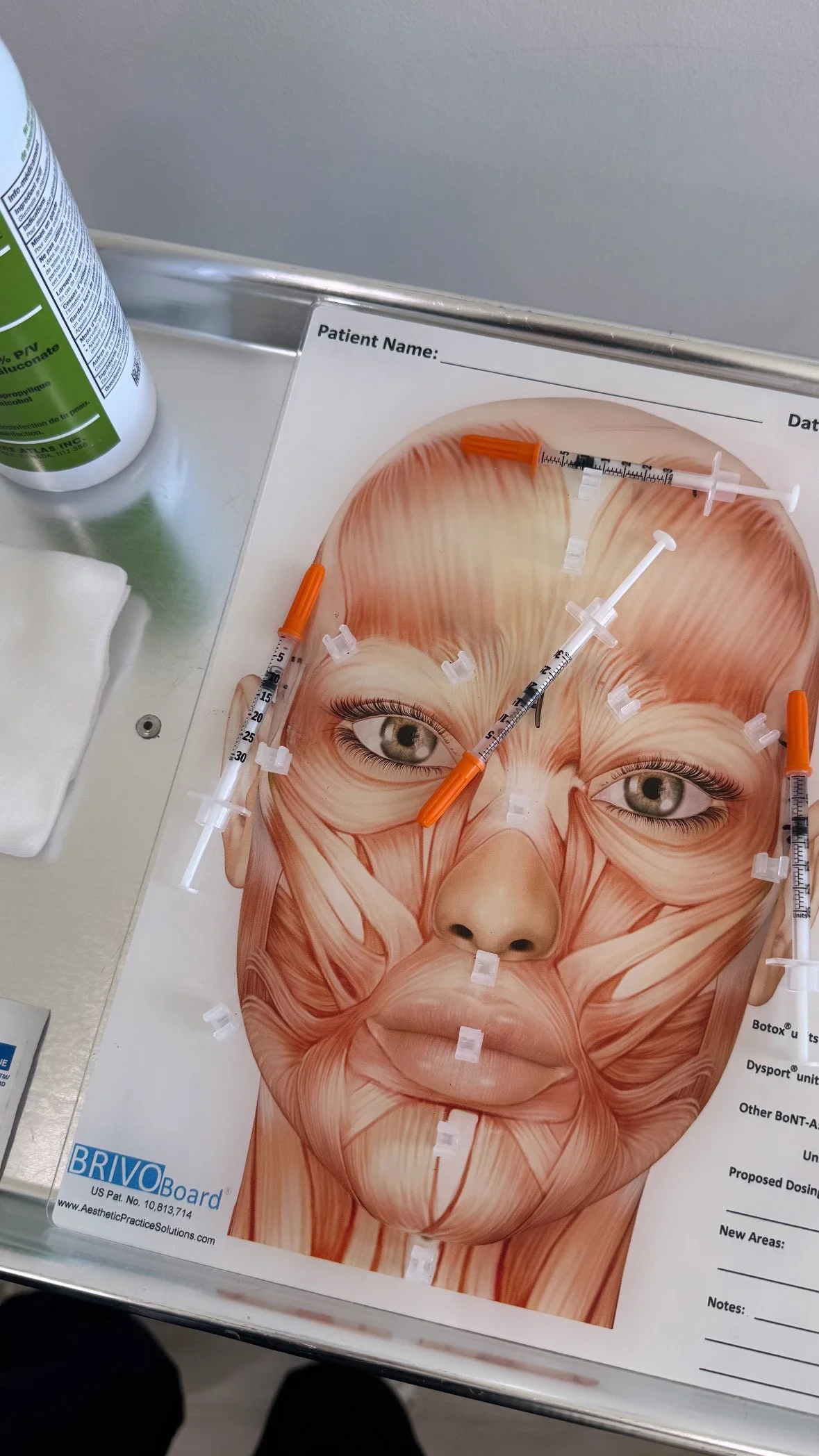 A medical diagram of a human face showing facial muscles with syringes placed on specific areas, likely for cosmetic injections.