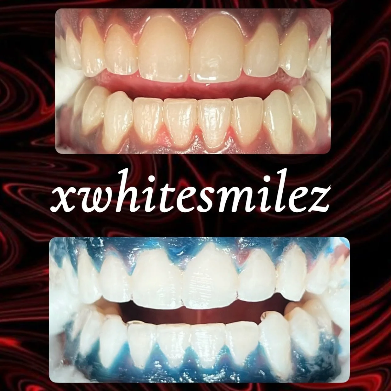 CITYBOYJJ ⭐️

Before and After!

#teethwhitening #teethwhiteningtoronto ##teethwhiteninghamilton #teethwhiteningburlington #teethwhiteningancaster #teethwhiteningguelph #teethwhiteningoakville #teethwhiteningmilton #teethwhiteningmississauga 
#teethw