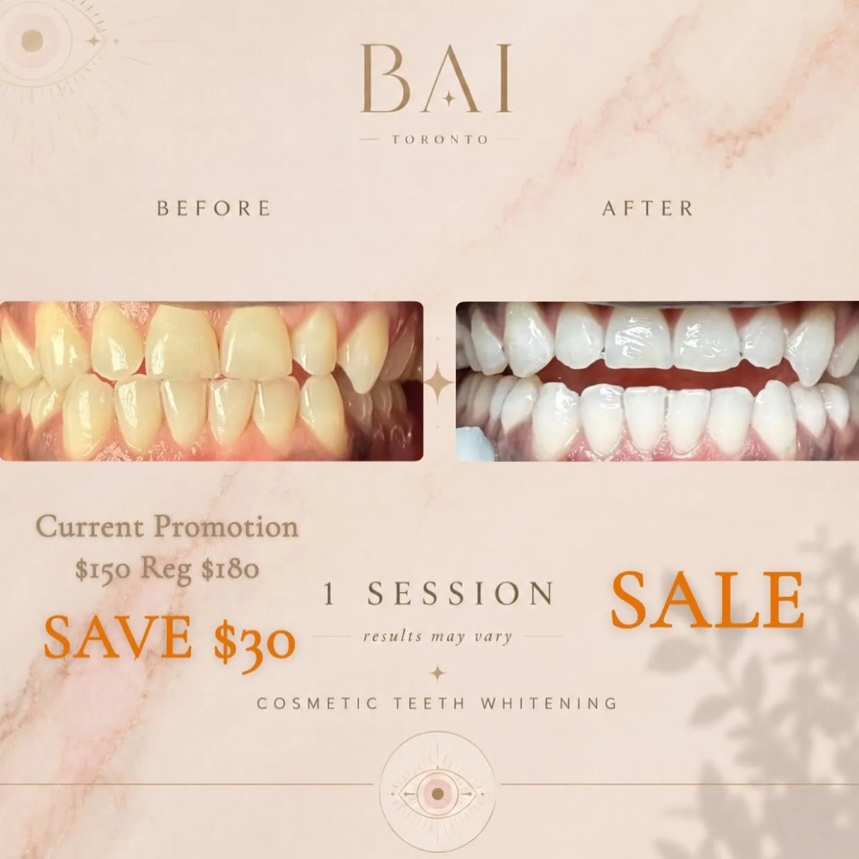 Real results 

📍Etobicoke by appointment only 
🪬Required $50 deposit 
✅Results guaranteed 
😄Pain free minimal to zero sensitivity