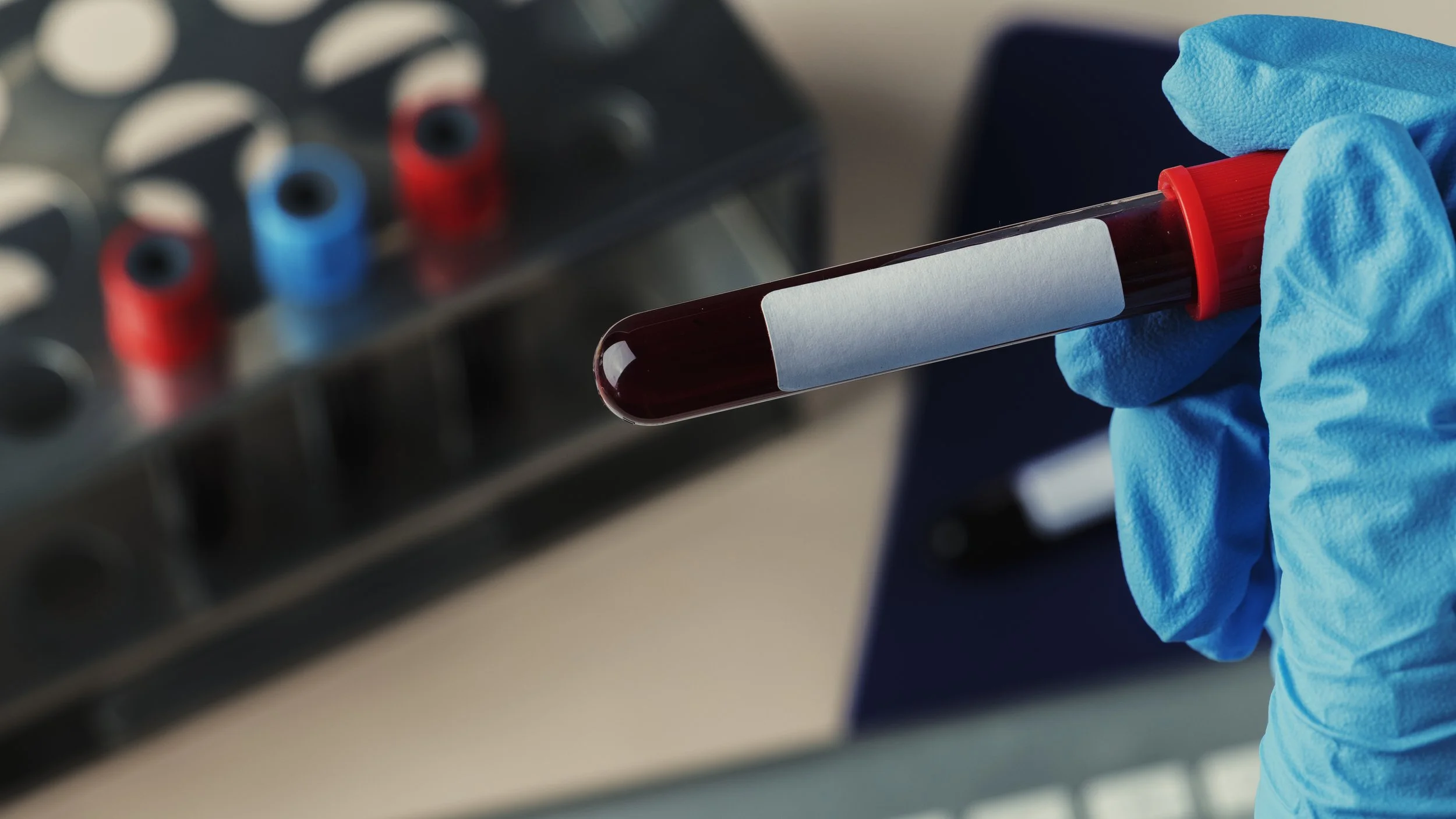 Hand, die einen Probenröhrchen mit Blut. blauer medizinischer Handschuh trägt, in ein Labor oder medizinisches Umfeld.