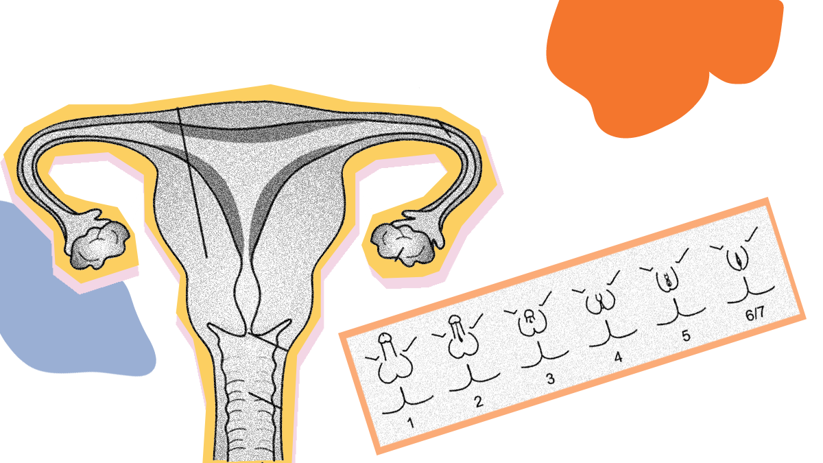 Anatomy of a vulva and the Quigley scale which is a visual system used to assign sex to genitalia.