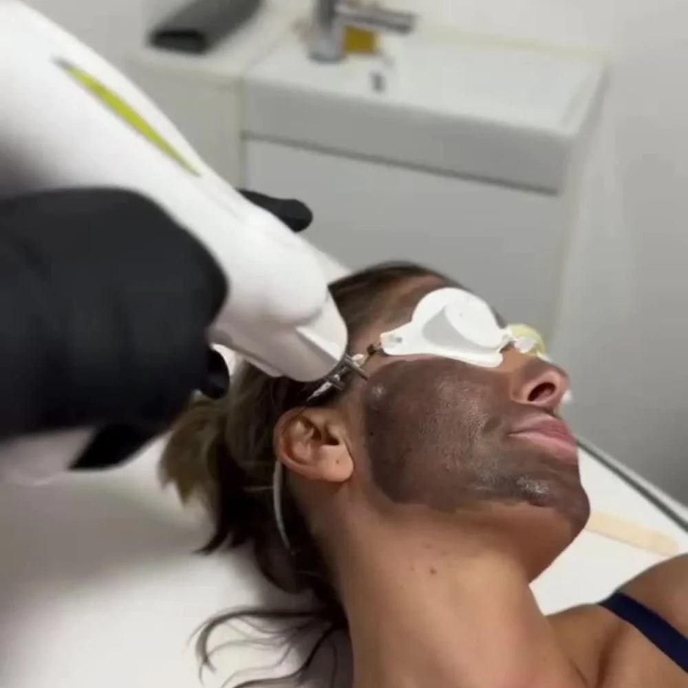 A person receives a cosmetic or dermatological treatment on their face from a medical professional who is holding a device. The person is lying down with protective eye goggles on.