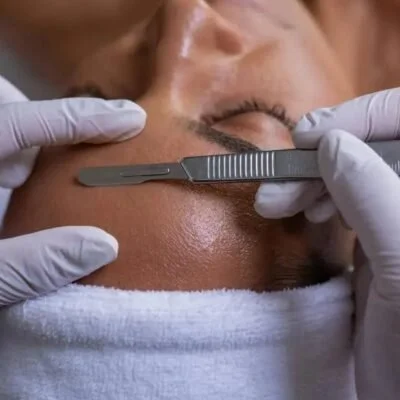 A person receiving a professional skincare treatment or extraction, with gloved hands holding a tool near their face.