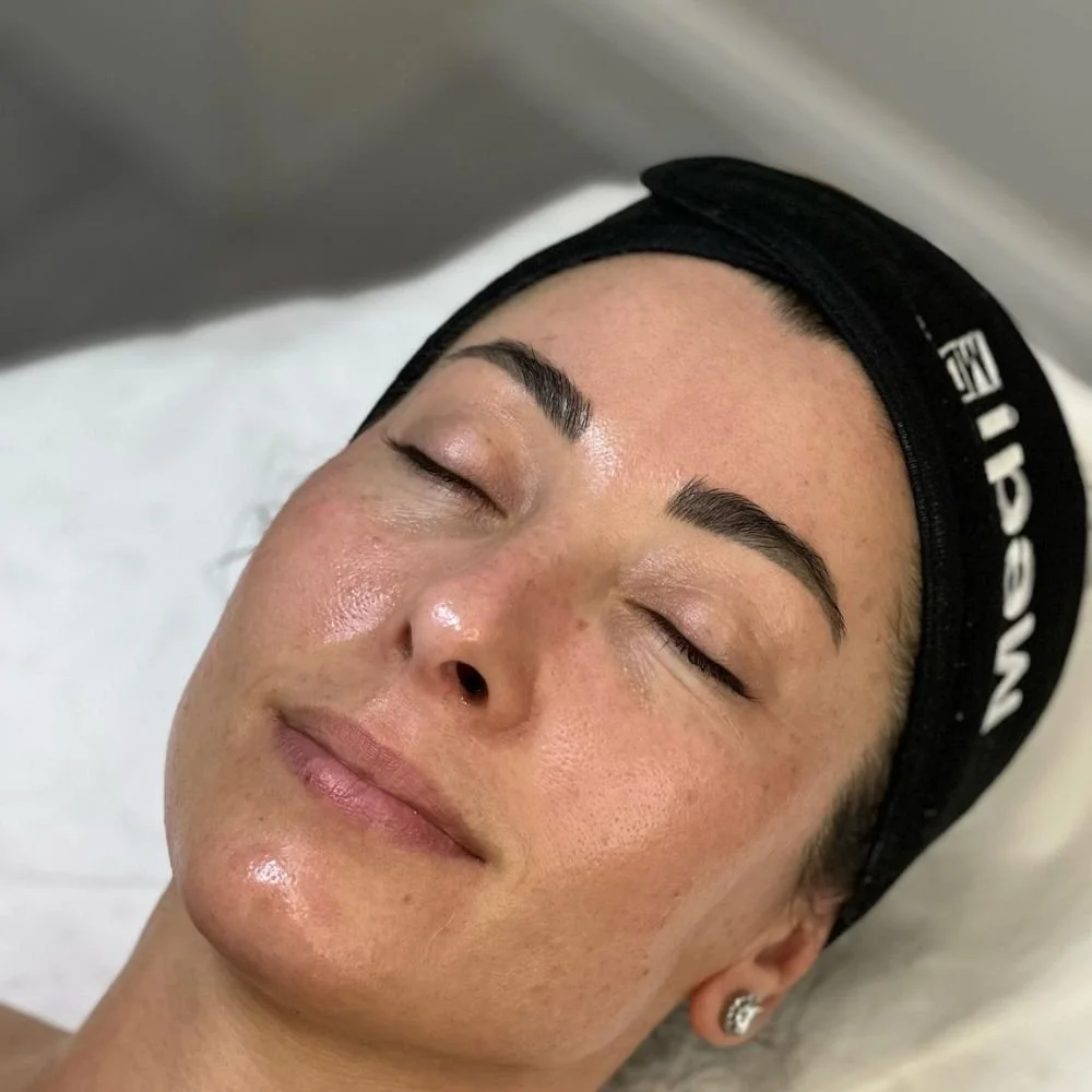 Clinical Skin Radiance Peel.jpg