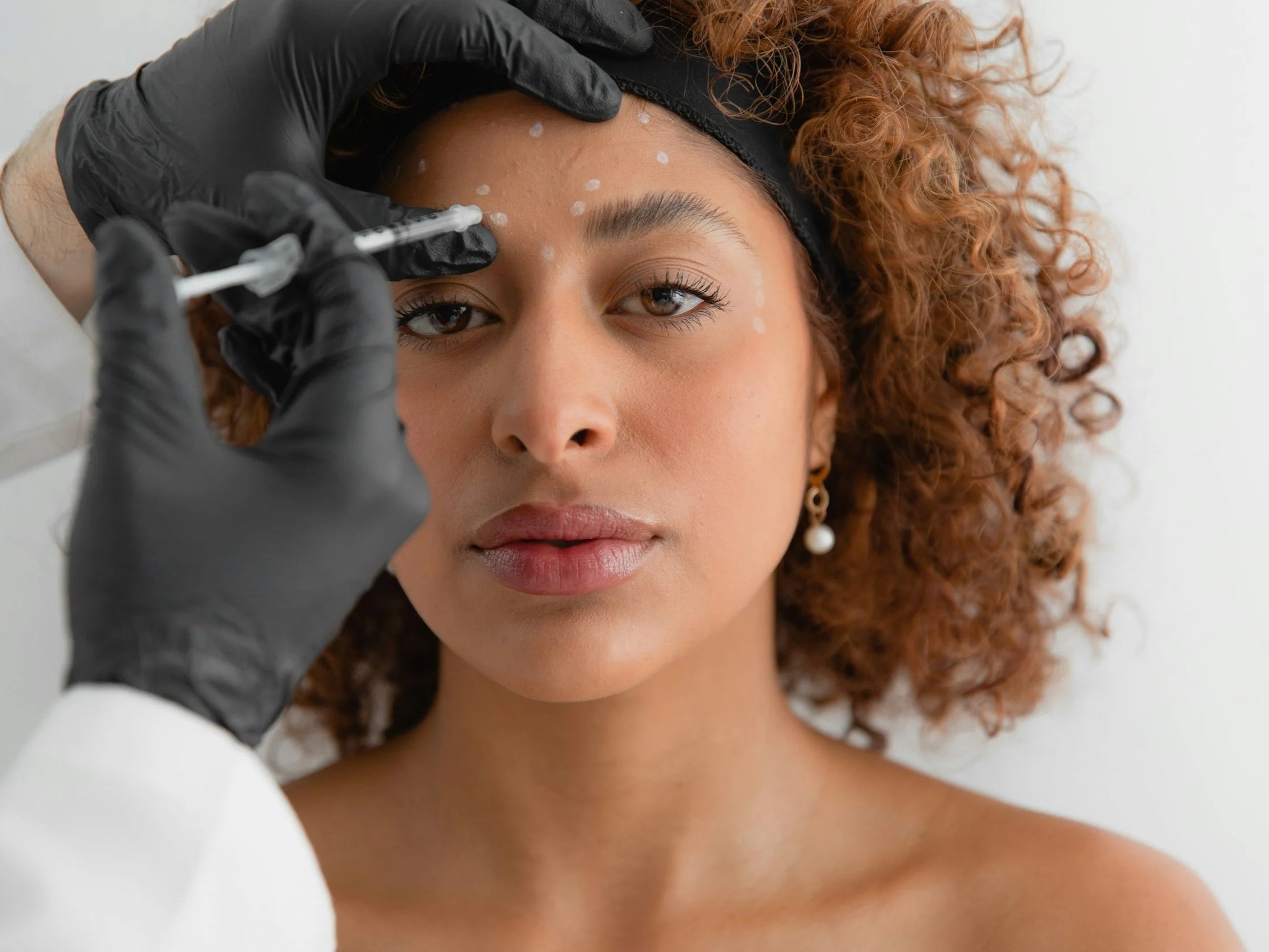 Femme allongée qui regarde la caméra, elle est en train de faire des injections de botox à Québec