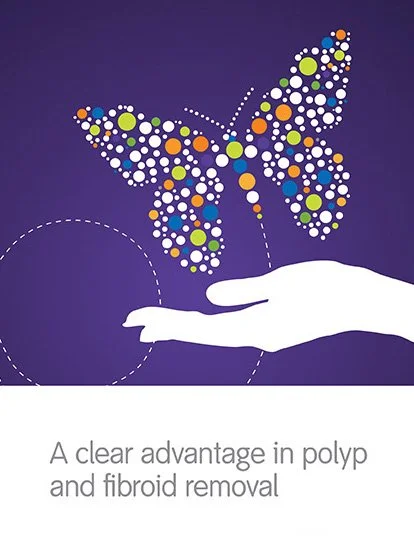 Smith & Nephew: Truclear Brochure