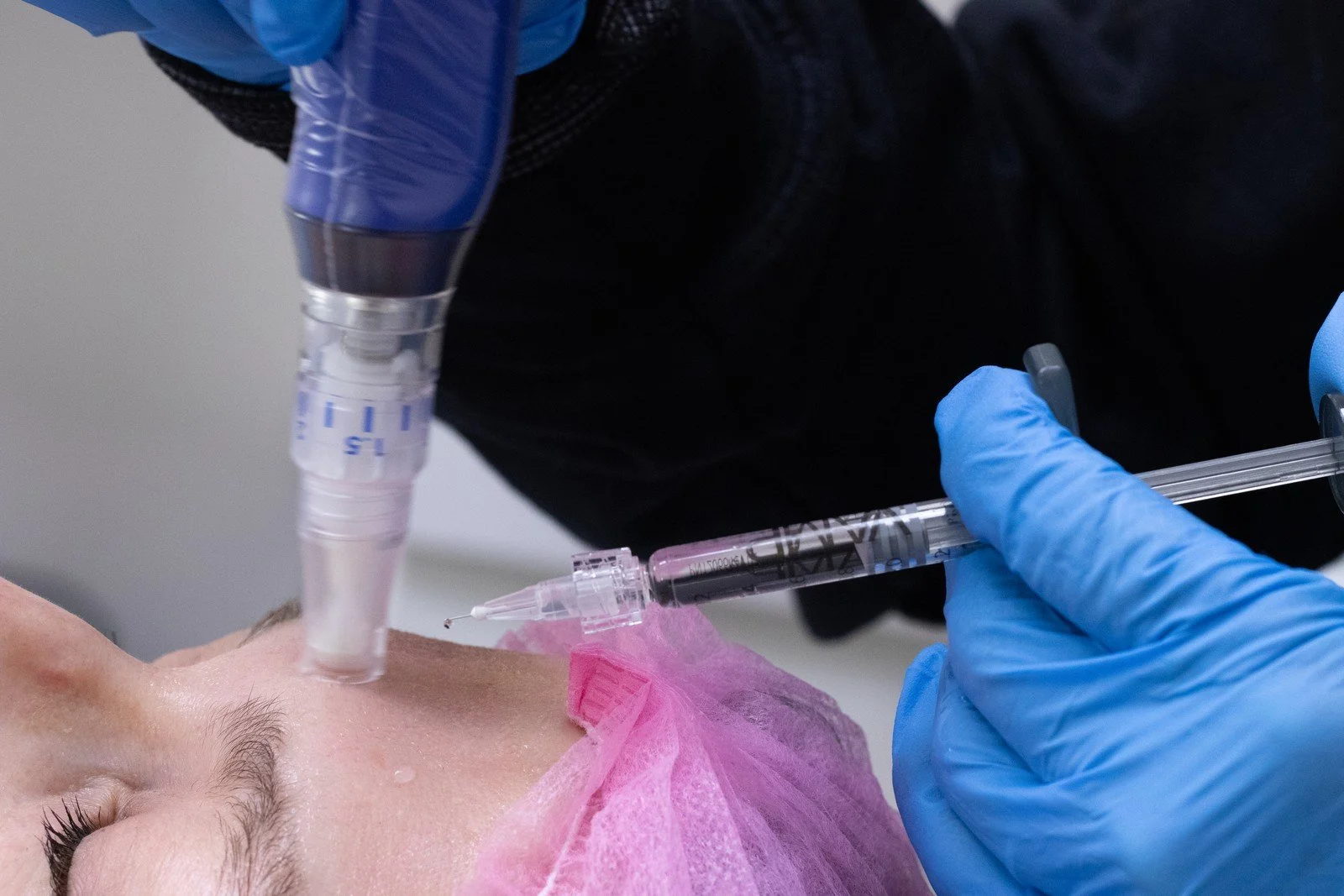 Microneedling-Vampire-Facial_0400.jpg