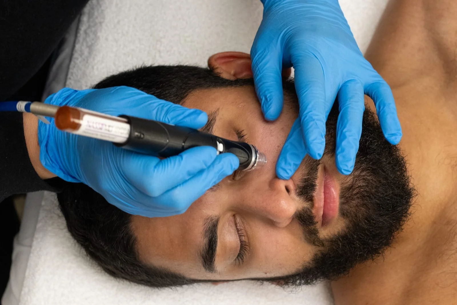 Signature-Hydrafacial_7546.jpg